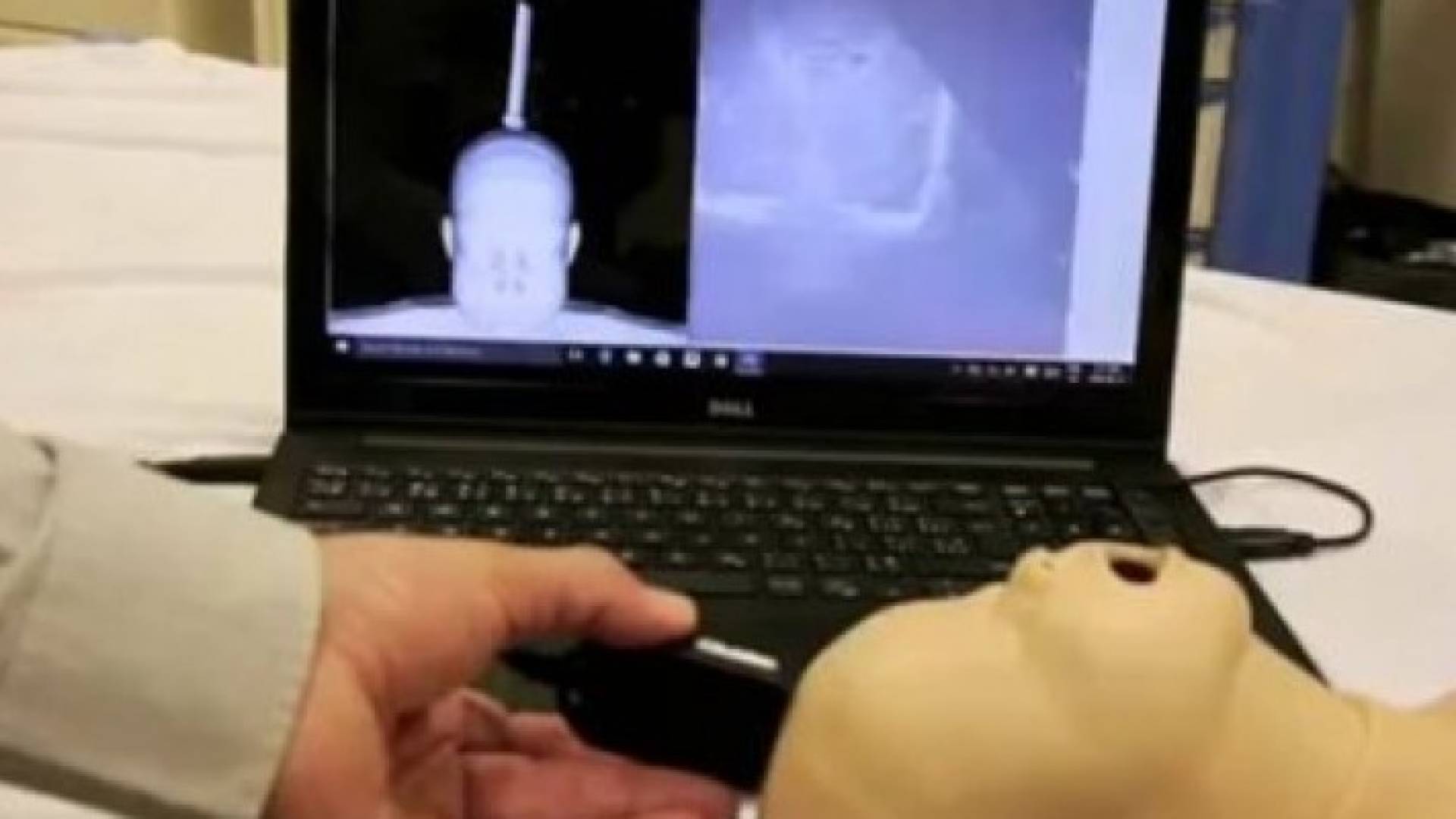 اختراع سوري ينقذ الأطفال مبكري الولادة بالتبريد.