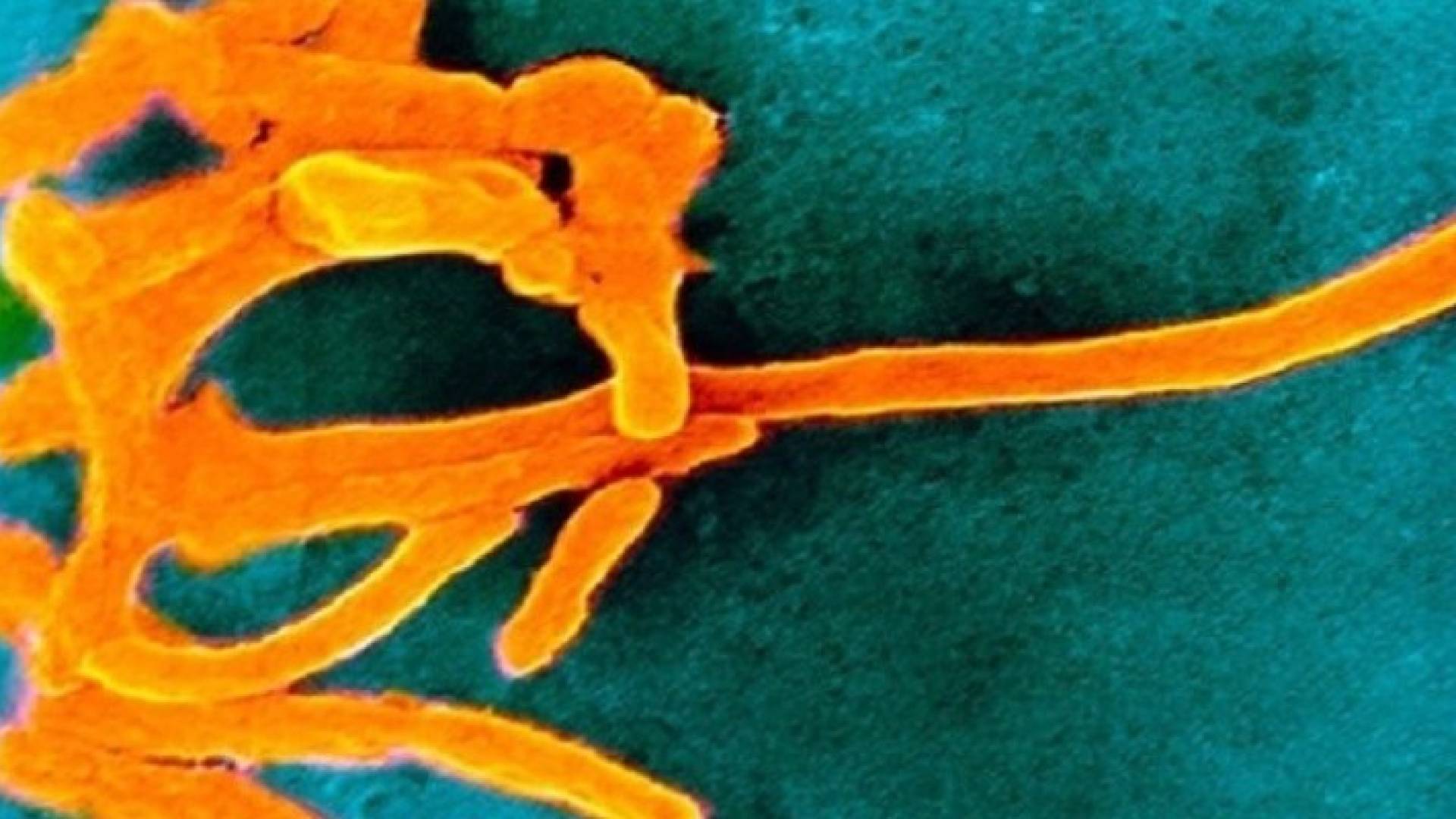 الفم غير النظيف قد يسبب سرطان المستقيم