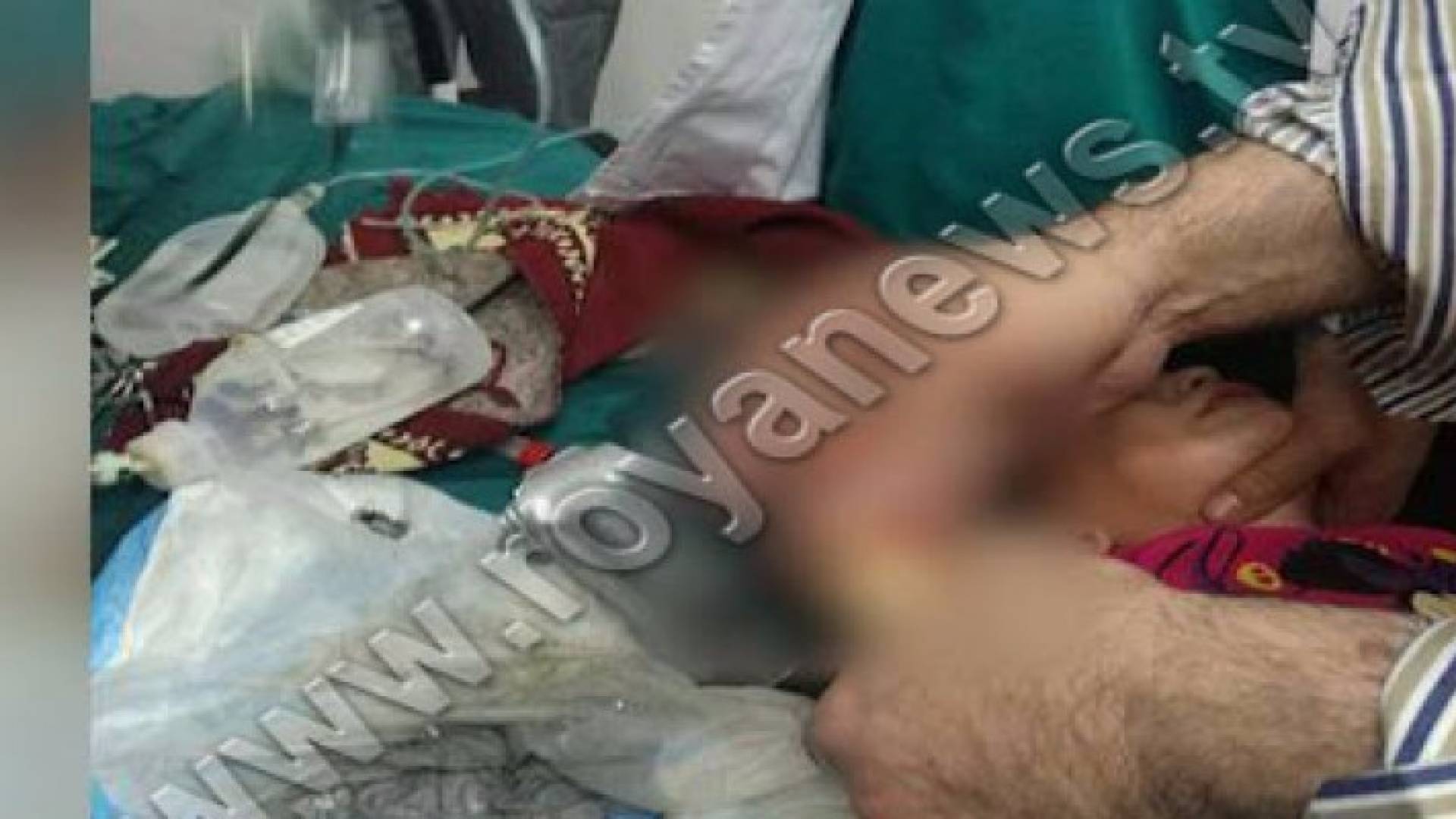 بالفيديو والصور: انقاذ طفلة علقت يدها في "مفرمة لحمة "