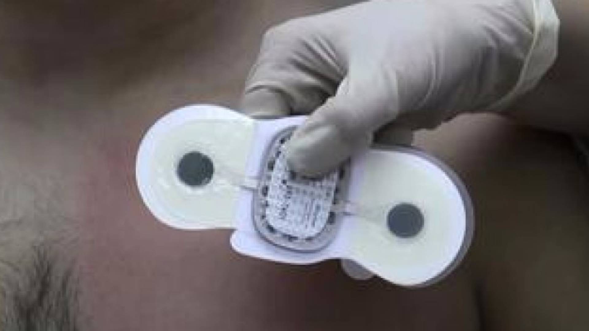 لصقة "ثورية" تراقب ضربات القلب