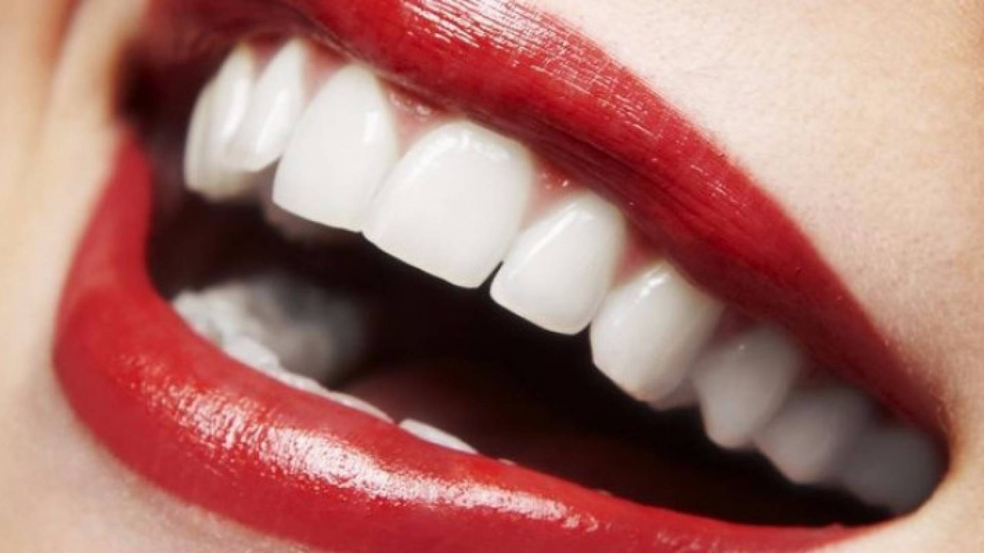 هذه أسهل أساليب تبييض الأسنان في المنزل