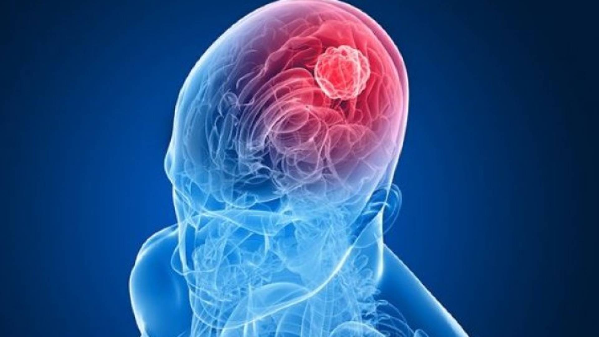 الصورة تعبيرية