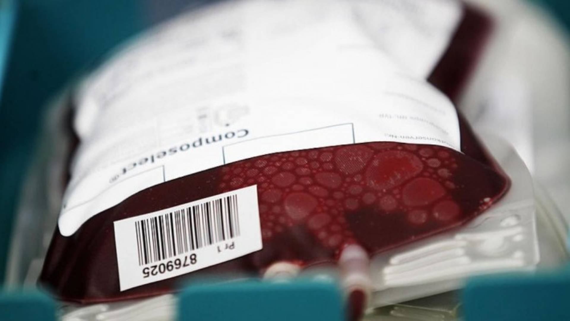 فحص تبرعات الدم أثبت نجاحه في الحد من تفشي المرض