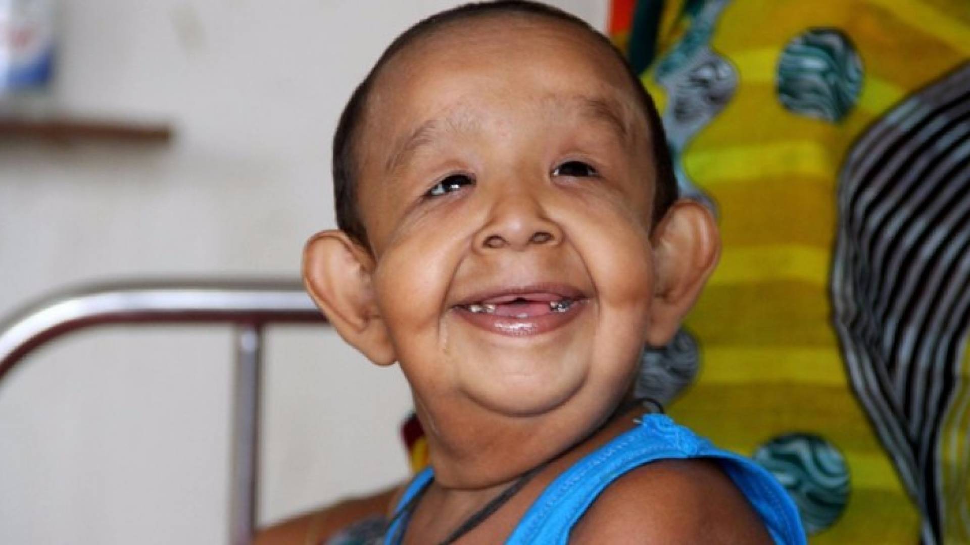 لغز "الطفل المسن" يحير الأطباء في بنغلادش