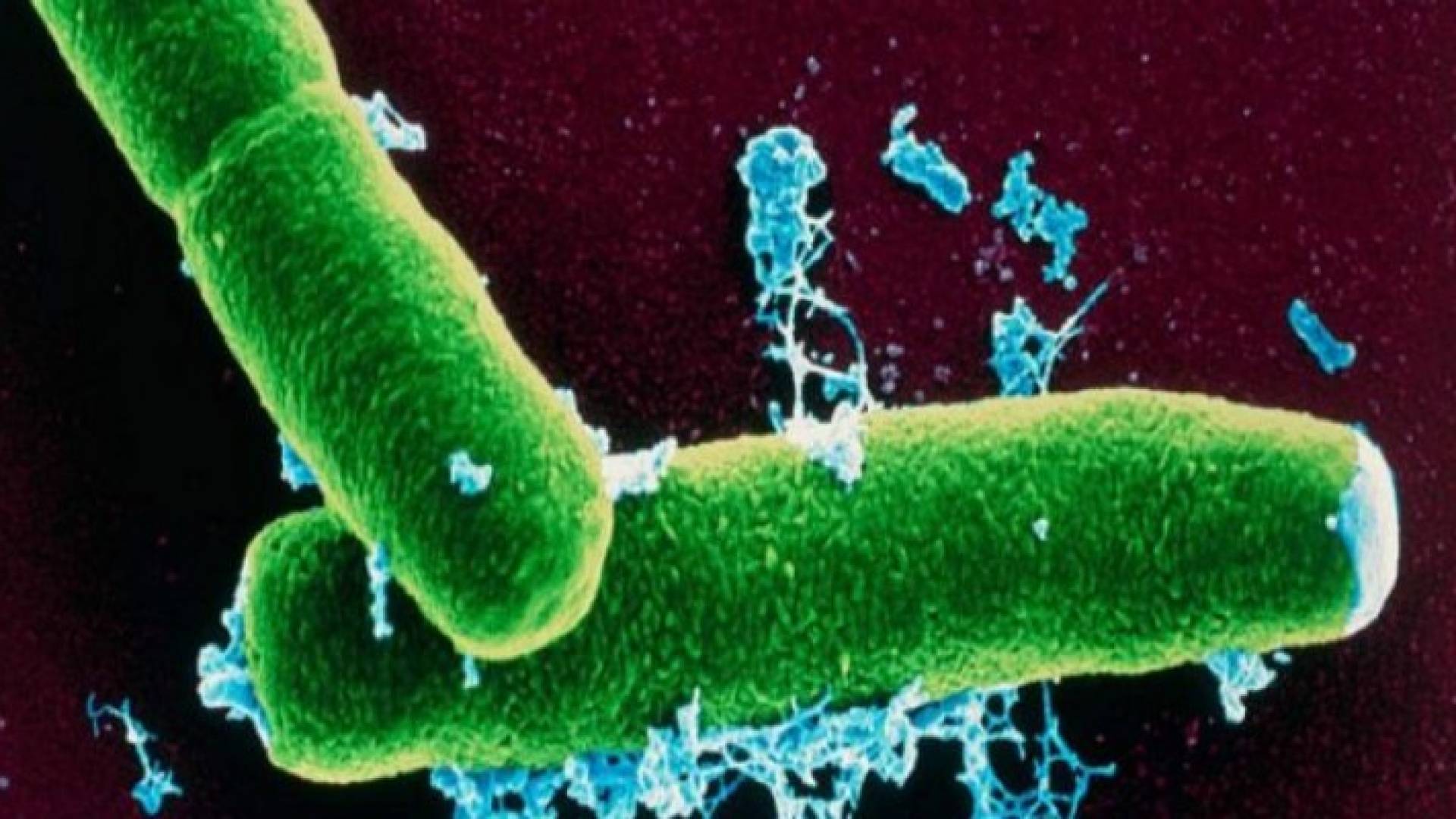 هل نشر أسلافنا "الجمرة الخبيثة" في جميع أنحاء العالم؟