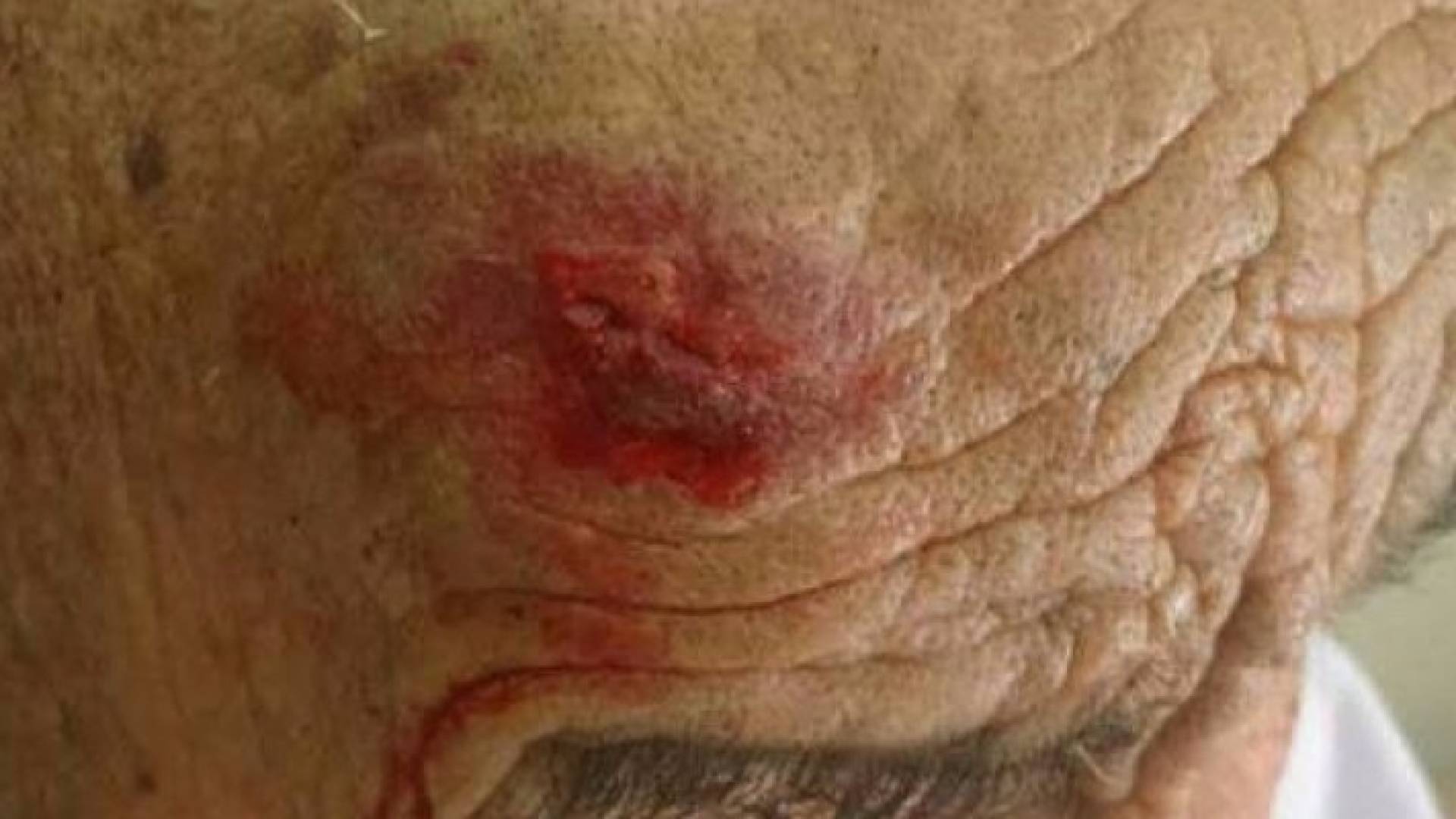 " التنمية " توضح حقيقة الاعتداء على مسنين في مركز ايواء