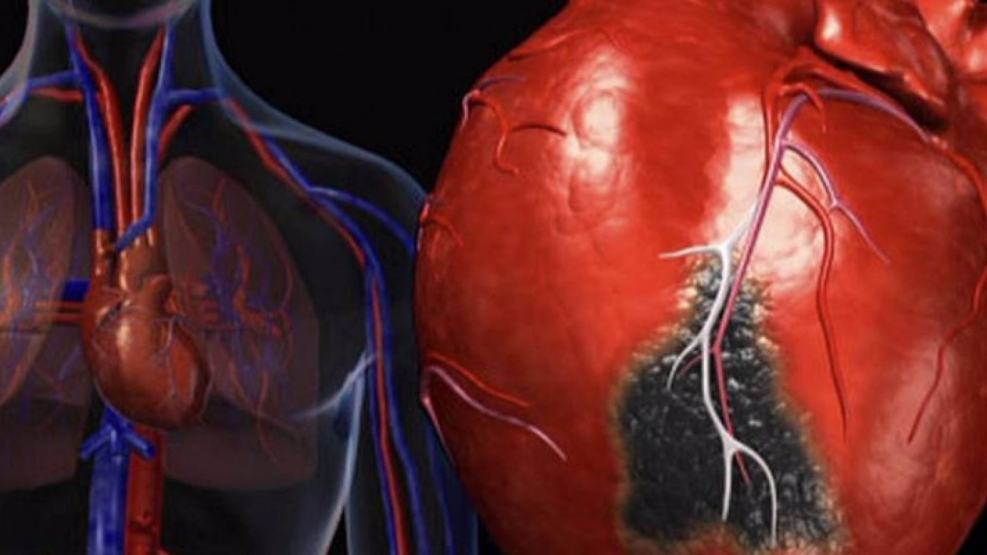 الـ"نودلز".. خطر على الصحة