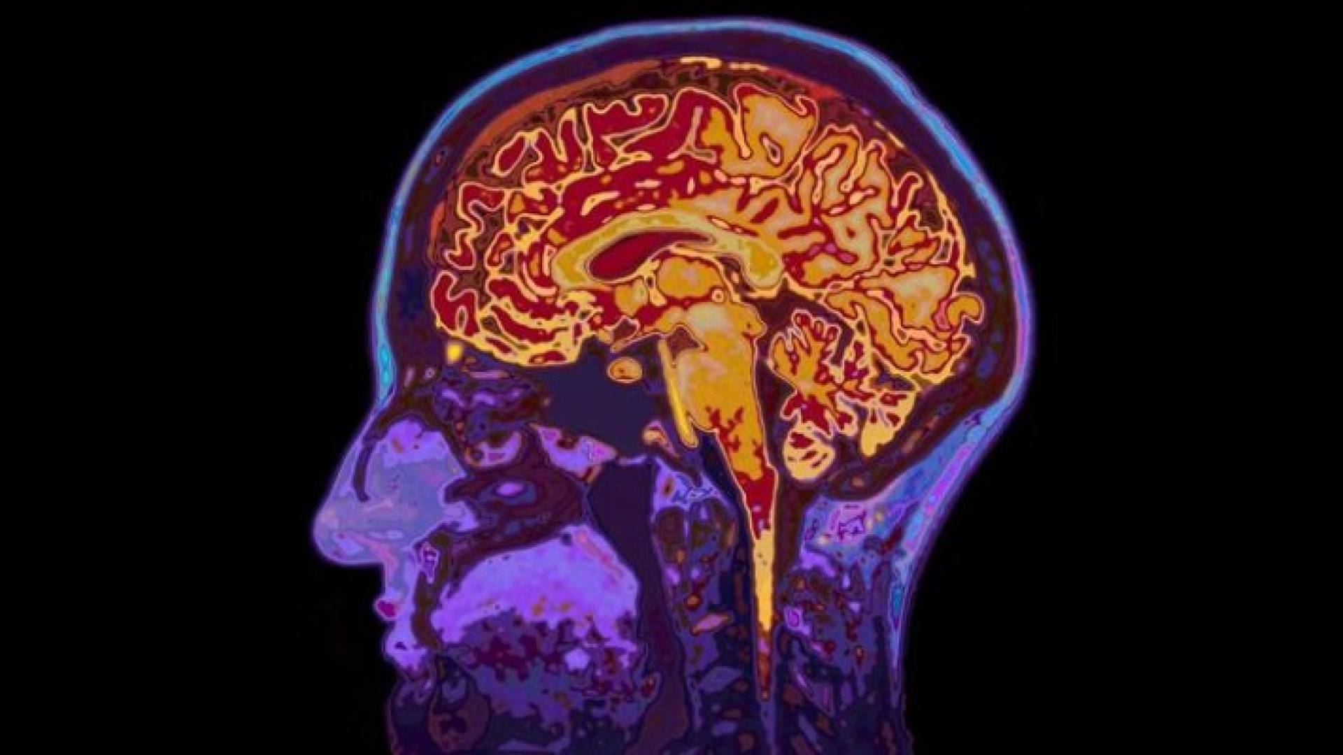 كيف تعمل عقولنا على تحليل اللغات؟