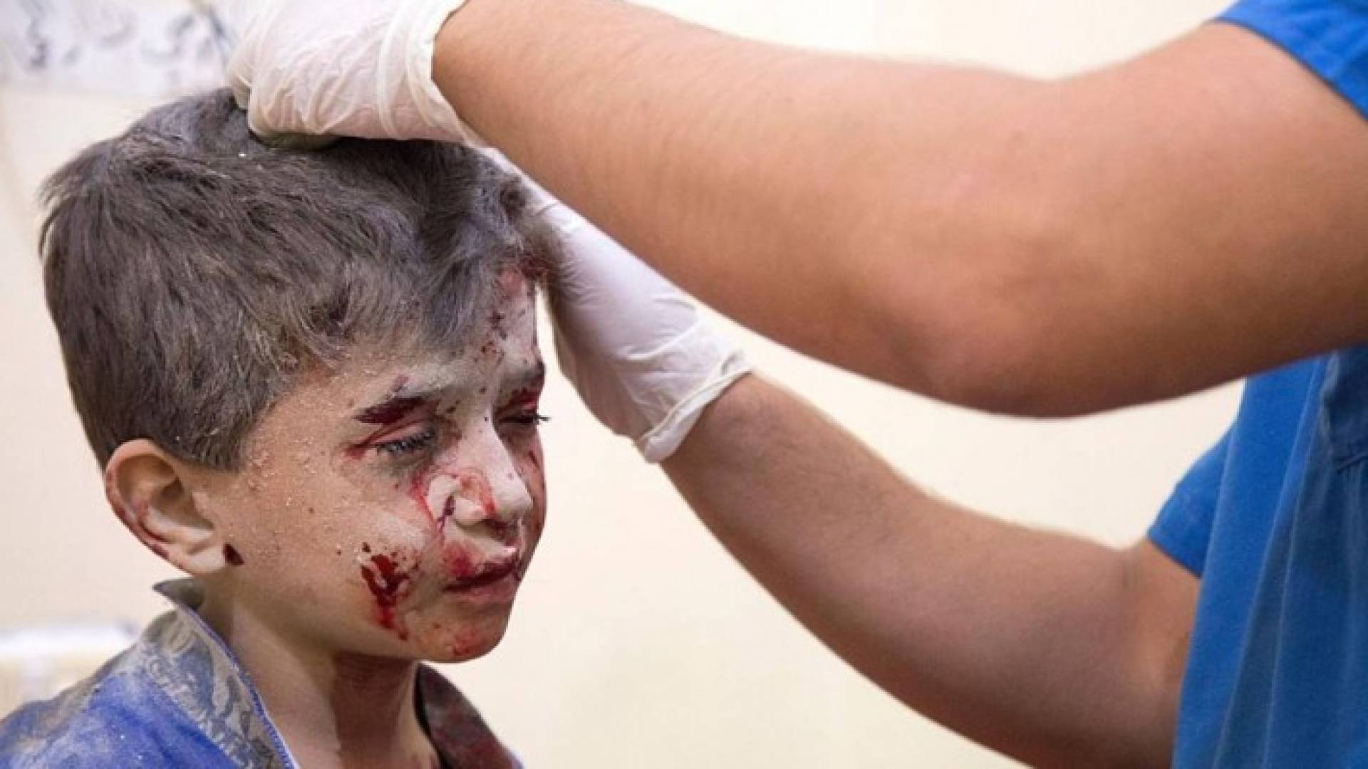 حلب.. عشرات القتلى وبرك من الدم