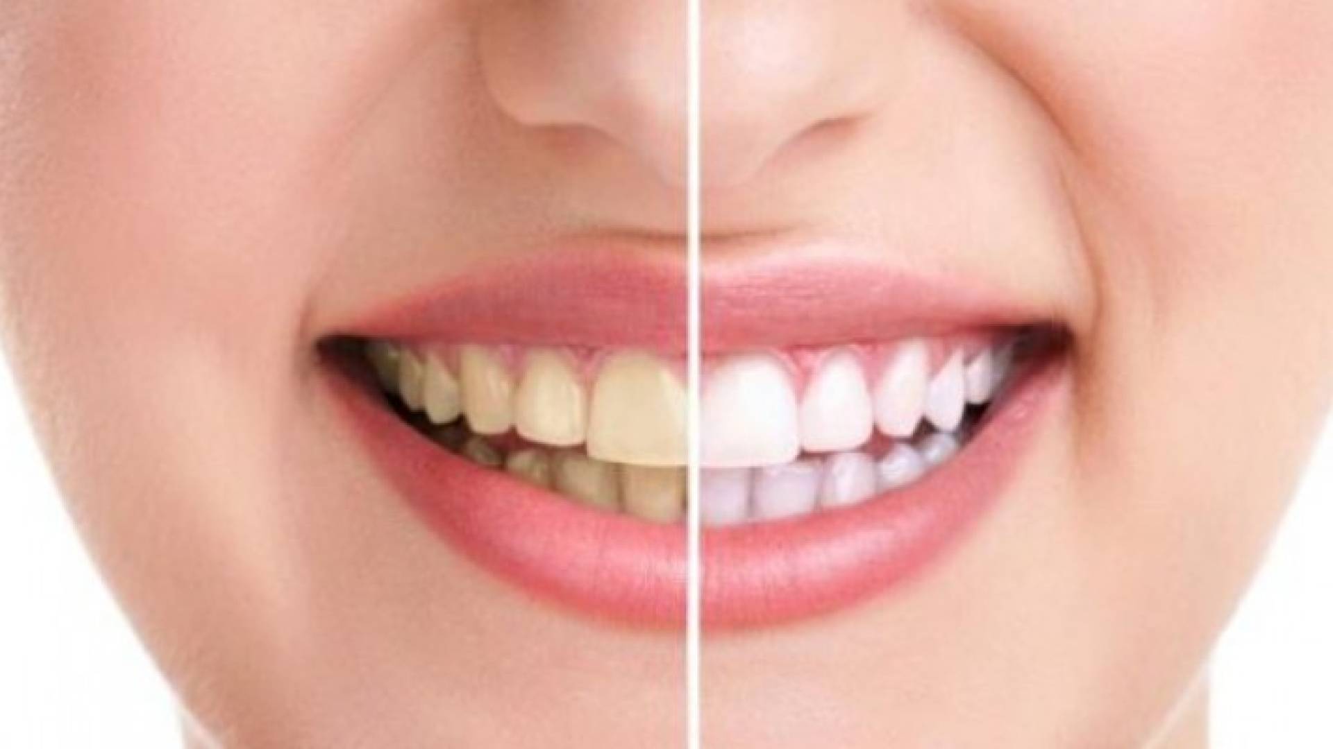 تنظيف الأسنان - صورة تعبيرية