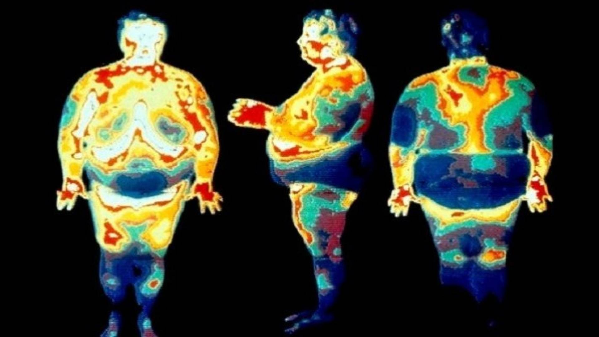 الميكروبات قد تكون السبب في السمنة 