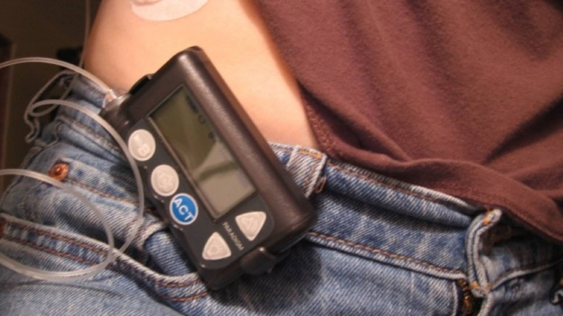 تحذير خطير لمرضى السكري : مضخات الأنسولين عرضة للاختراق