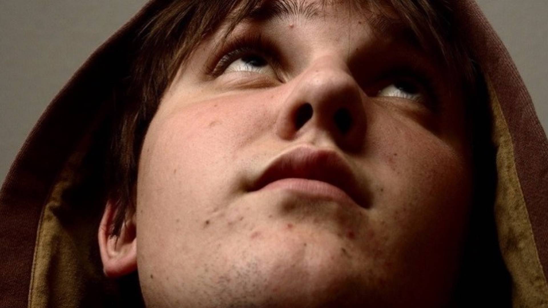 حب الشباب يحمي بشرة الإنسان من الشيخوخة