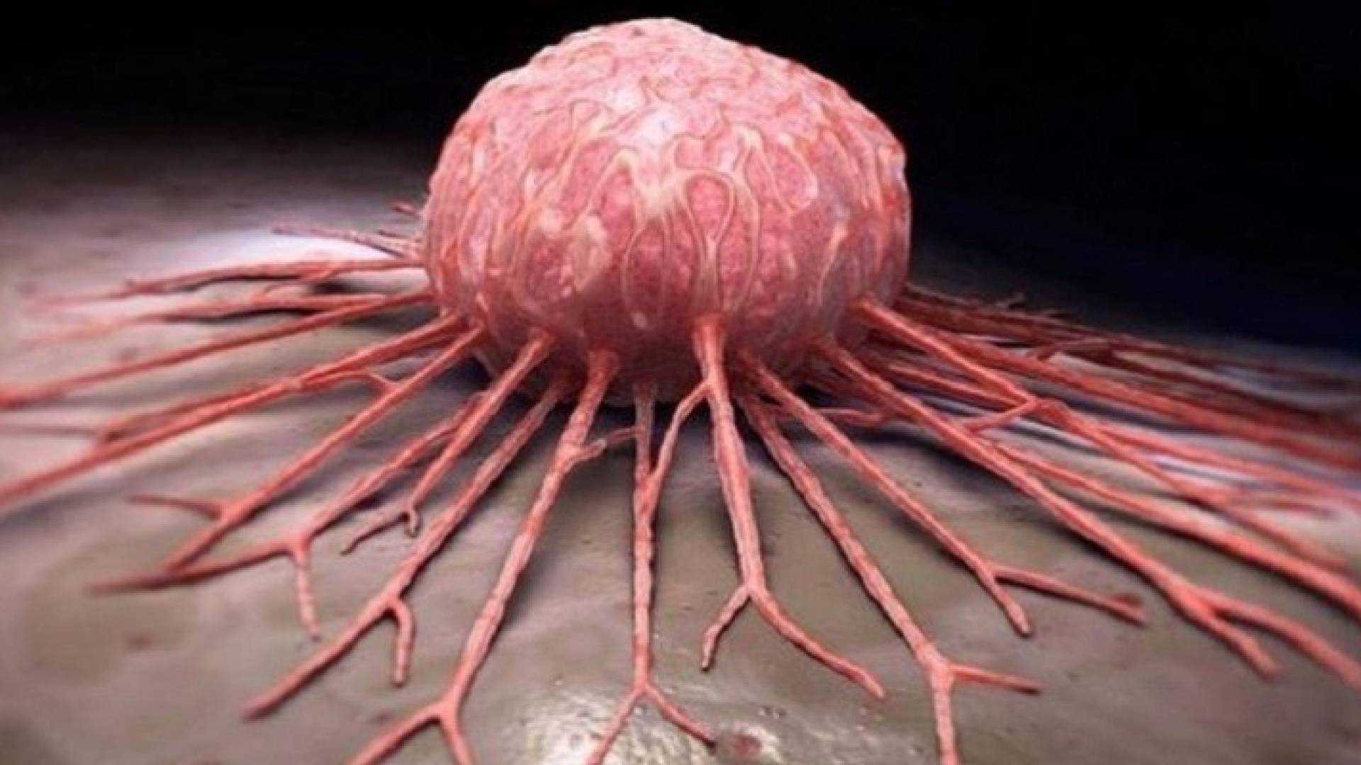 الخبراء يكشفون 8 طرق سهلة تقي من الإصابة بالسرطان