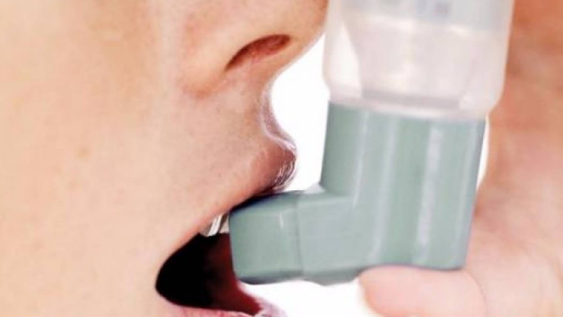 بخاخ جديد ينقذ الملايين من الموت بسبب تلوث الهواء