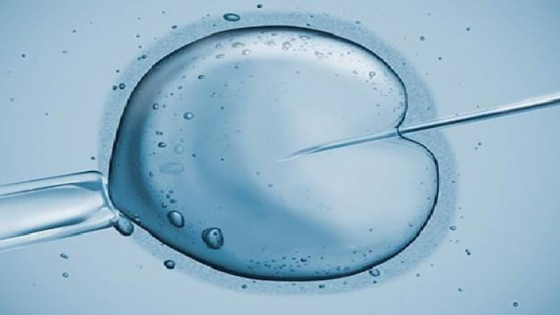 زيادة العيوب الخلقية بين أطفال الأنابيب