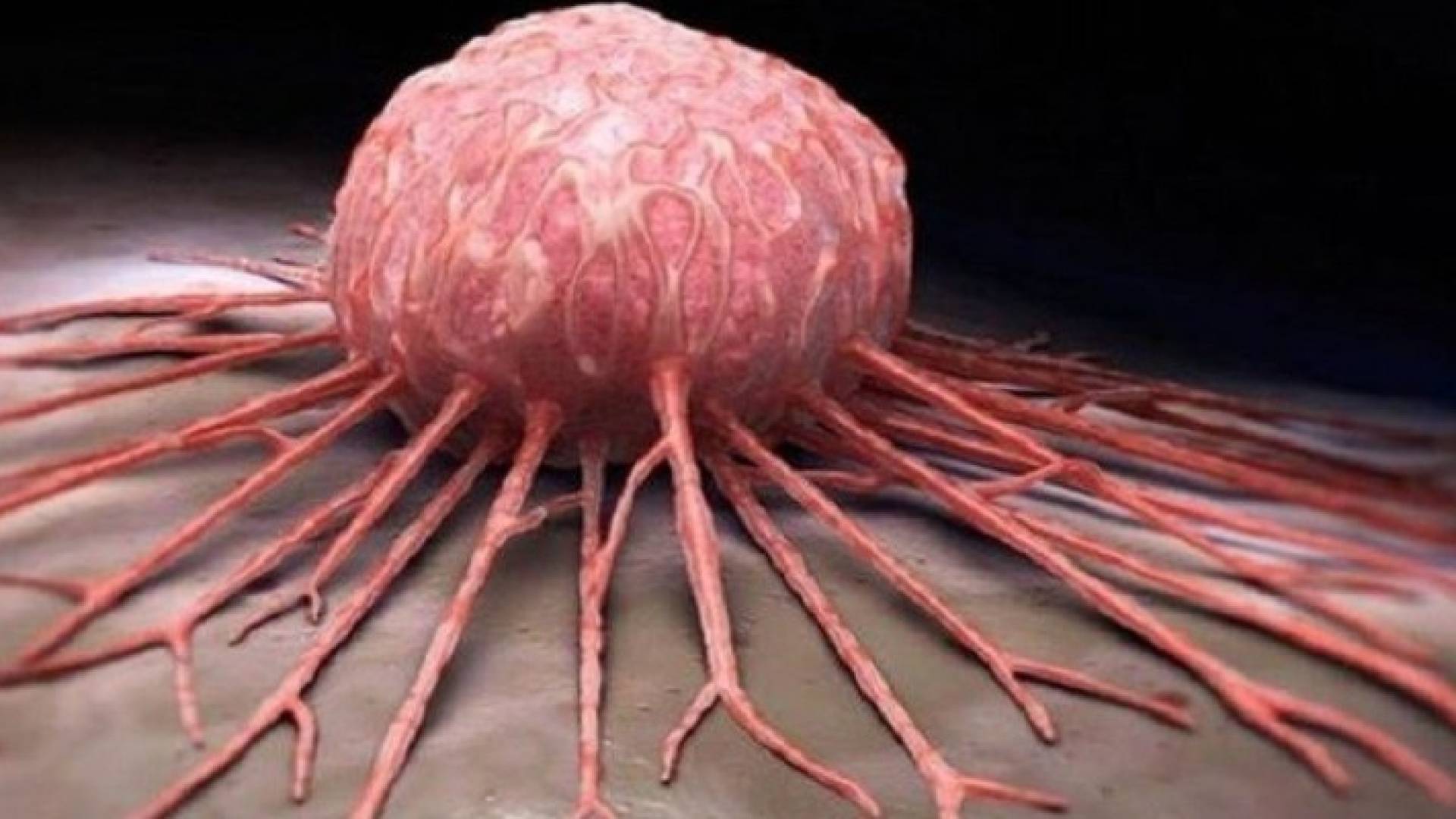 الخبراء يكشفون 8 طرق سهلة تقي من الإصابة بالسرطان