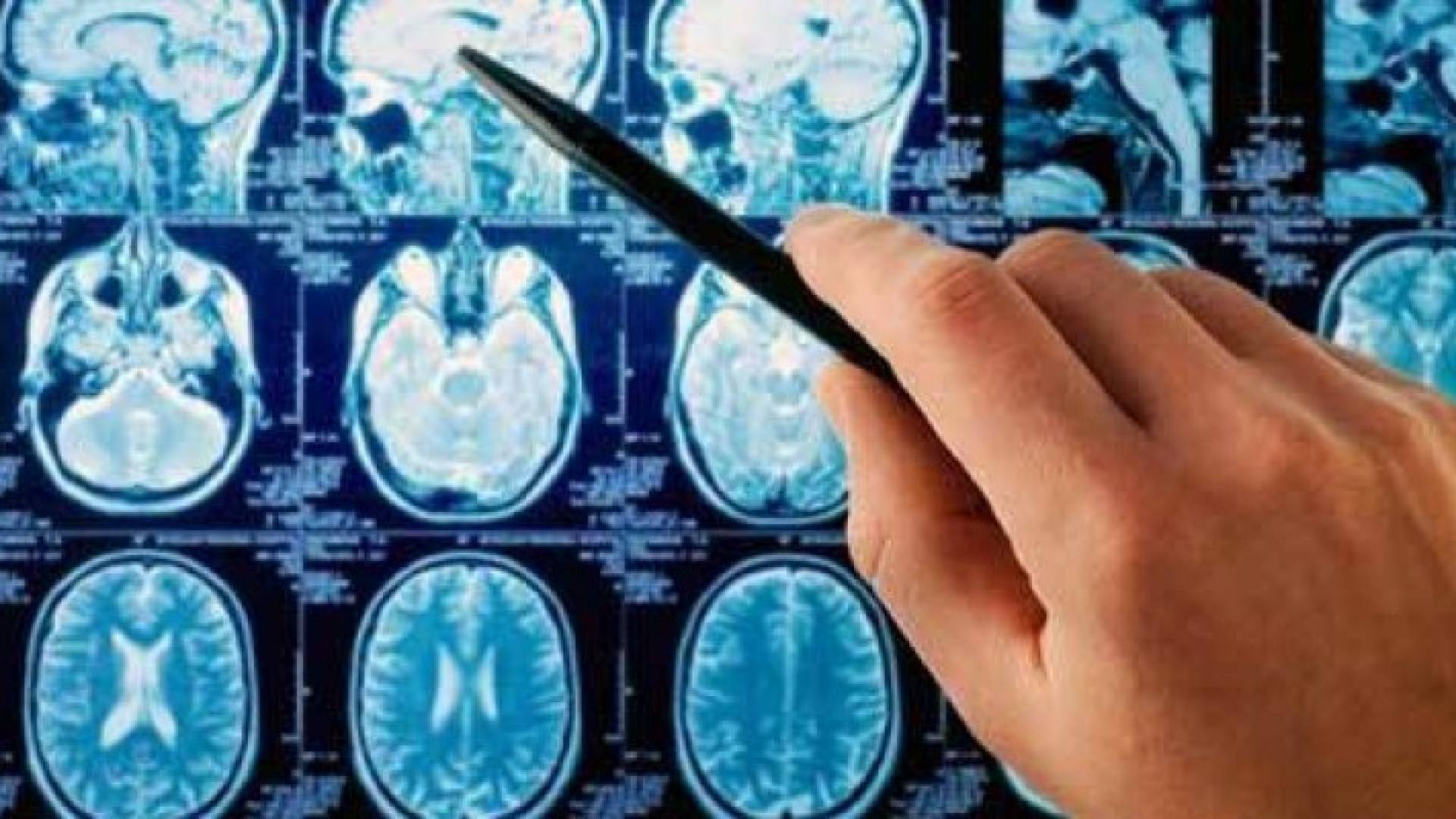 دواء جديد لعلاج سرطان الرأس والعنق أكثر فعالية من الكيماوي