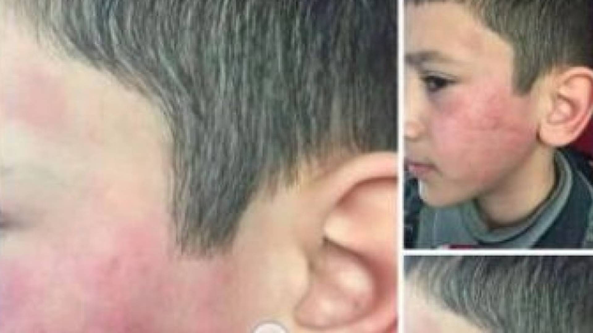 صور الطفل كما انتشرت على مواقع التواصل الاجتماعي 