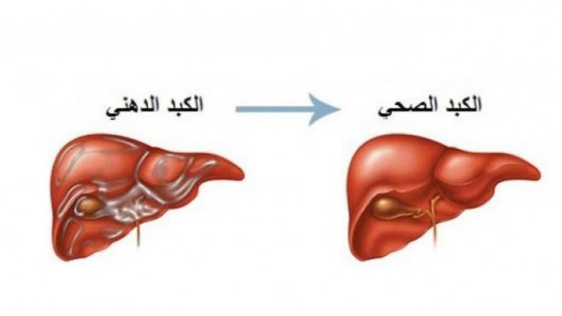 الكبد - ارشيفية