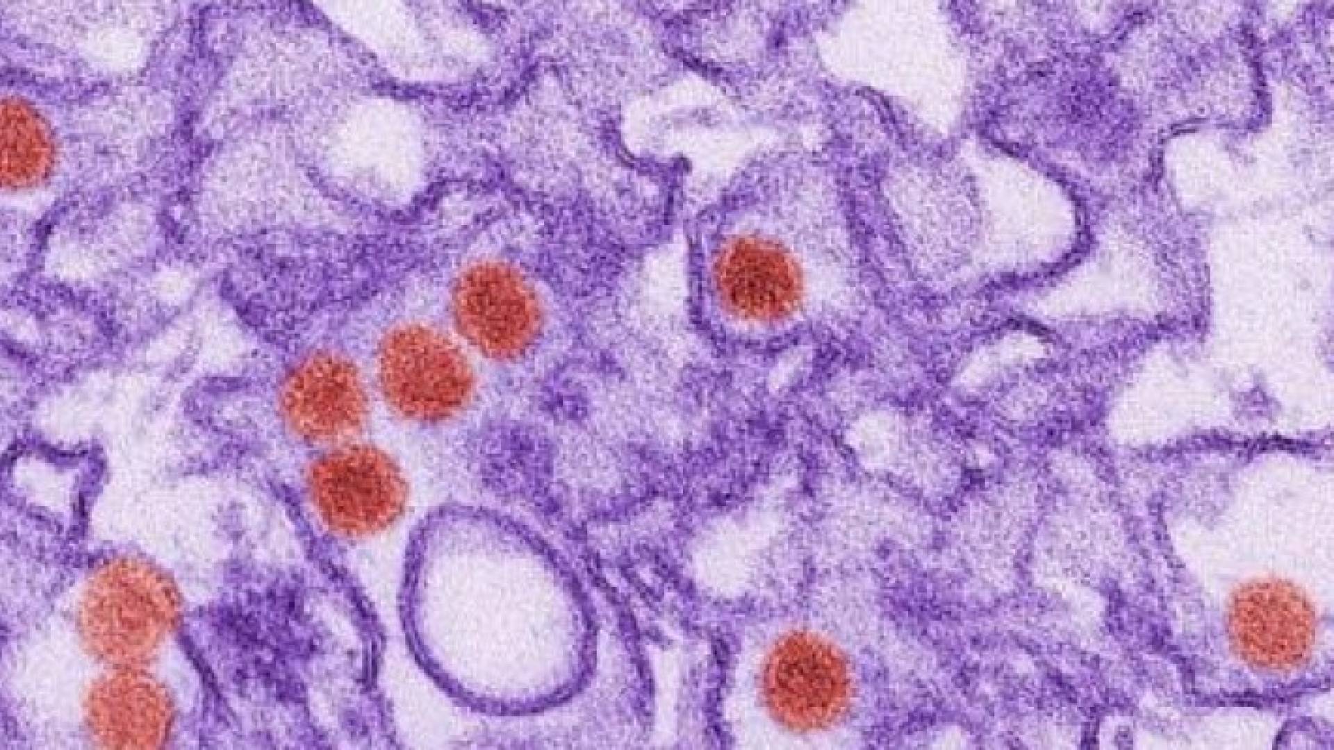 صورة مجهرية غير مؤرخة لفيروس زيكا 