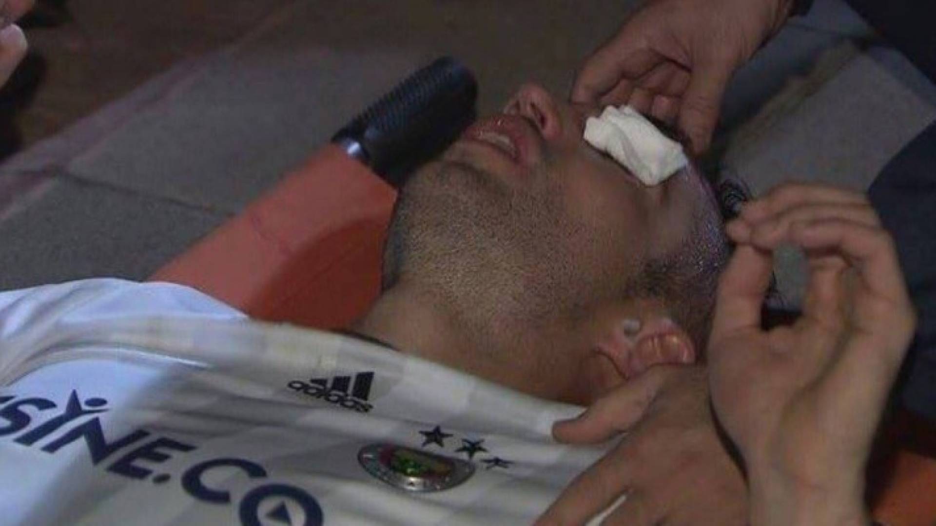 فان بيرسي يتعرض لإصابة خطيرة 