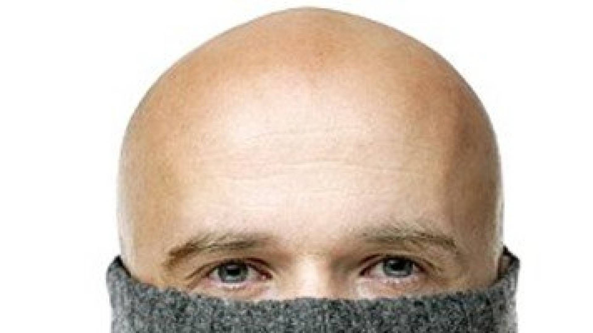 7 أسباب تؤدى بالرجال إلى الصلع فى سن مبكرة.. تعرف عليها