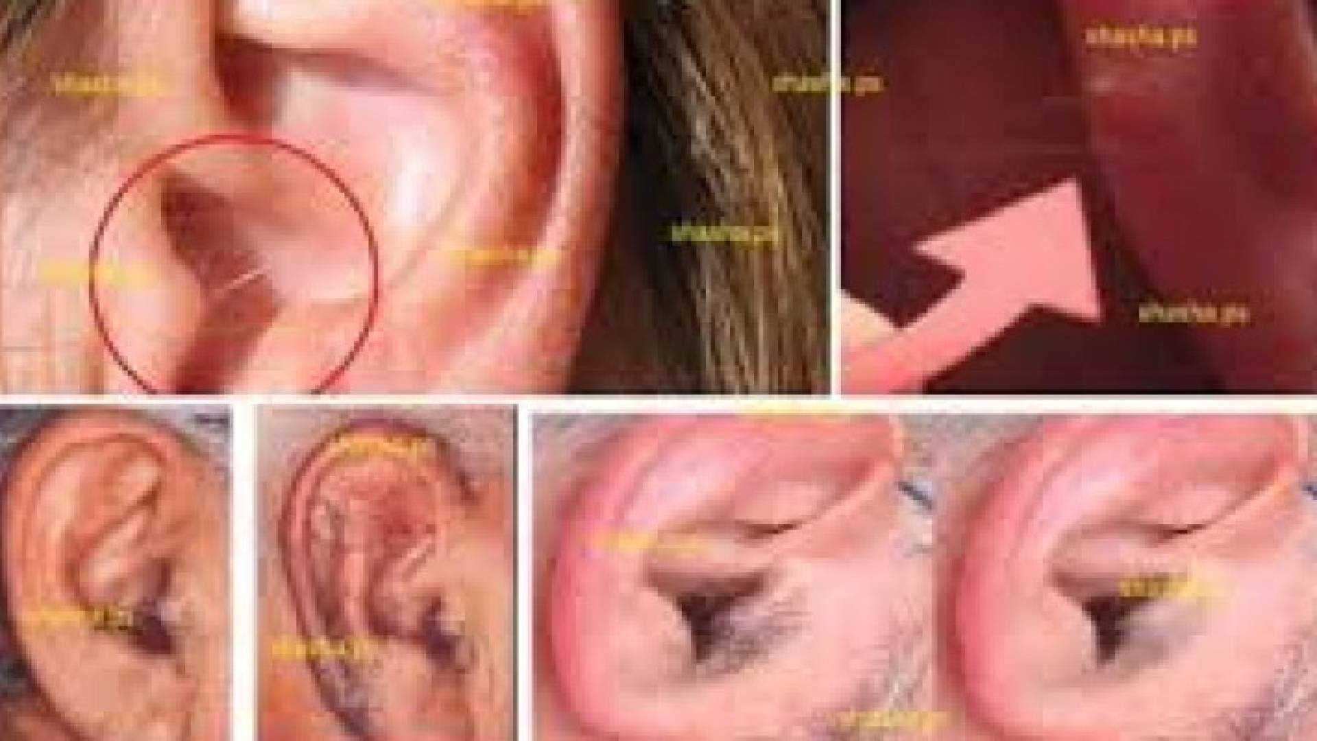 الاذن - تعبيرية