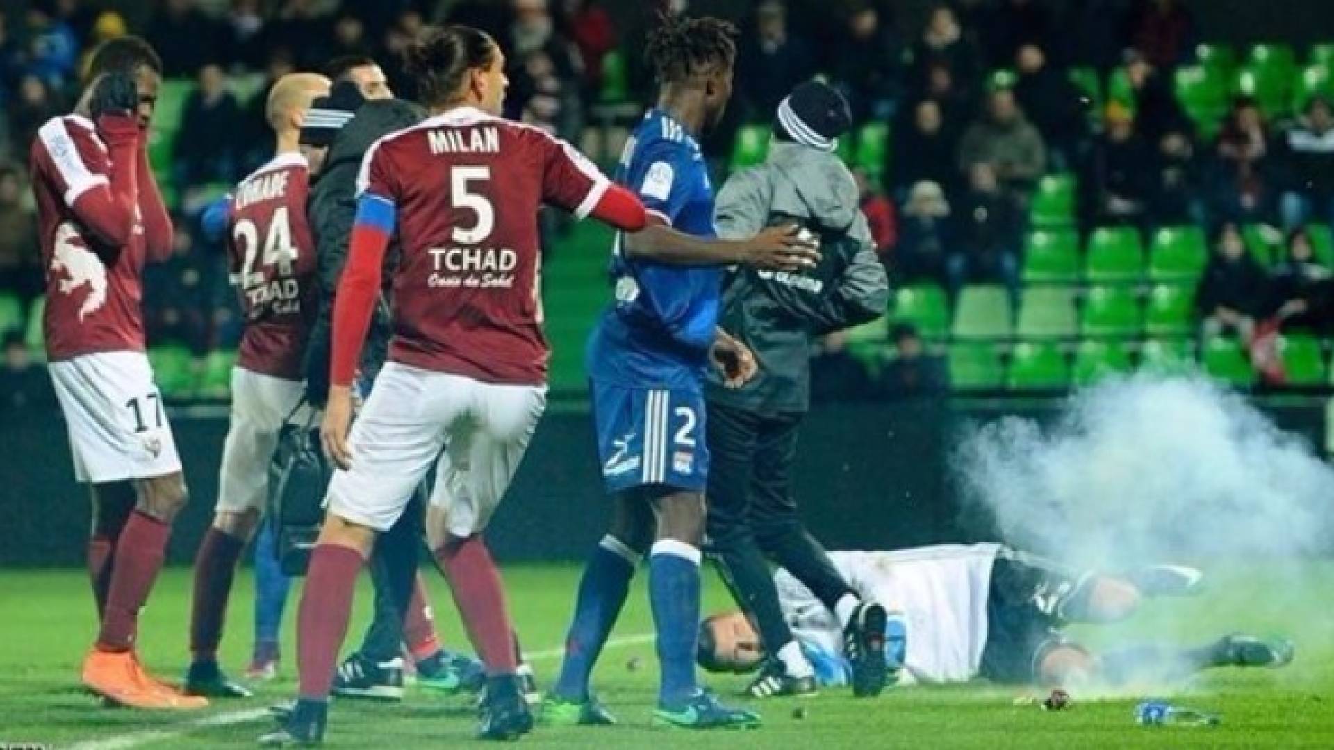 نادي ليون يعلن أن حارس مرماه أنطوني لوبيز تعرض لفقدان السمع