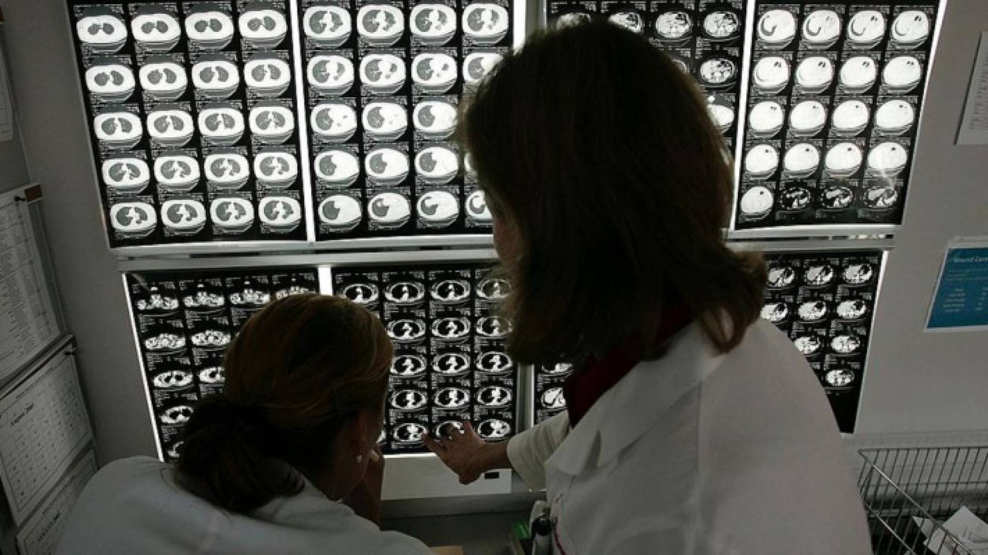 انخفاض الوفيات مرتبط بتطورات التشخيص والعلاجس