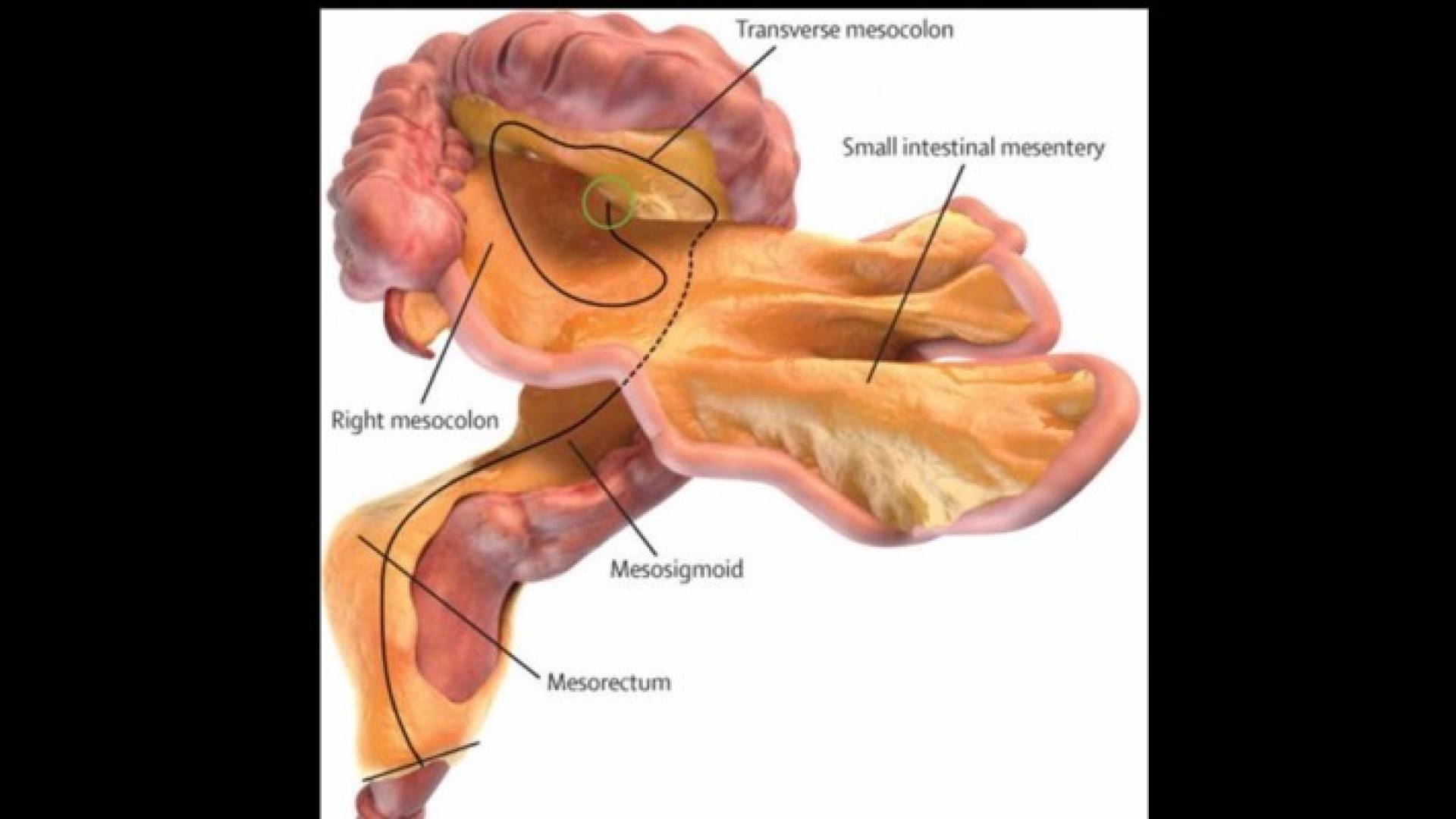 الأغشية المبطنة للأمعاء ثبت أنها عضو مستقل ومتصل