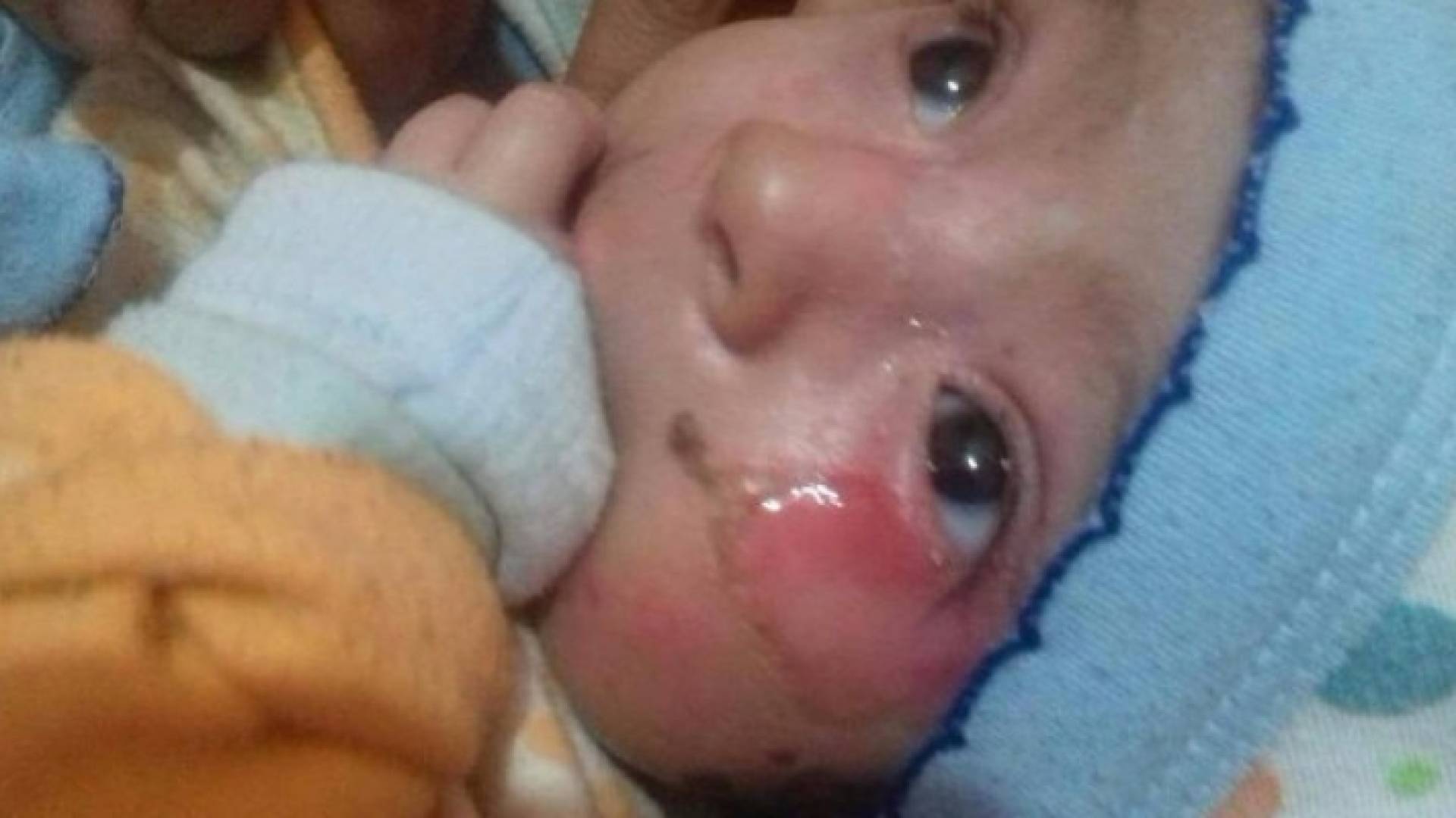 الرضيع مصاب بمرض نادر منذ ولادته