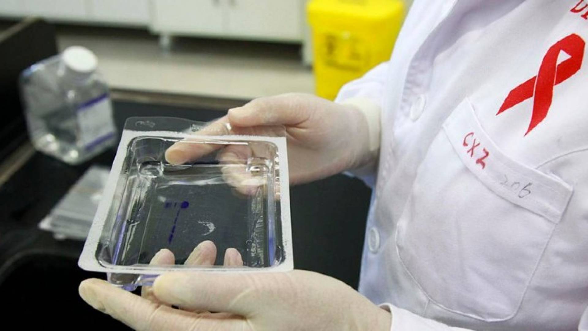 الإهمال تسبب في إصابة 5 أشخاص بمرض الإيدز