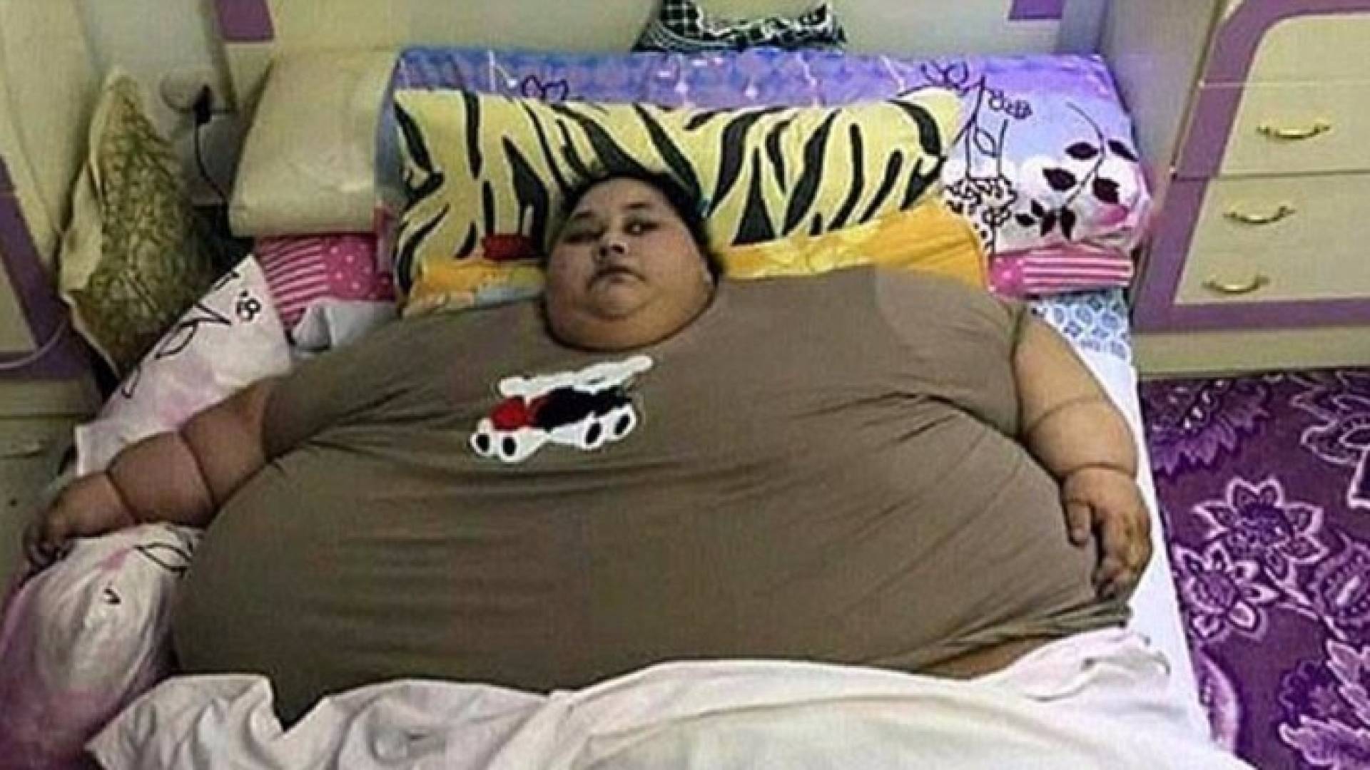 يتوقع الأطباء أن تتمكن إيمان من خسارة 400 كليوغرام في عامين.