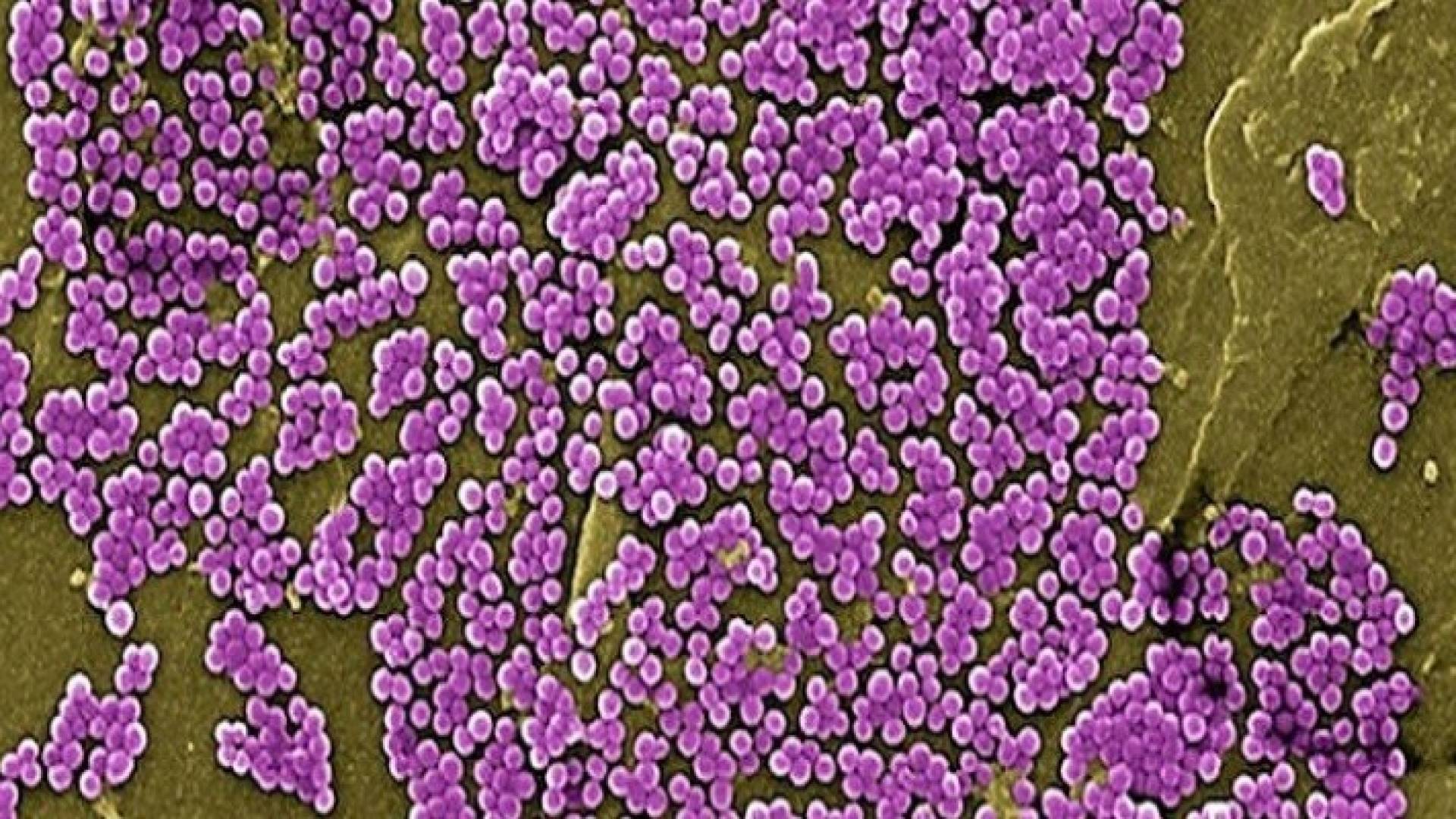 بكتيريا "MRSA"