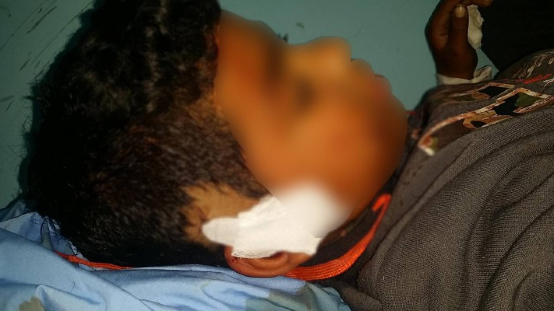 تعرض طفل للضرب بأداة حادة من قبل حدثين