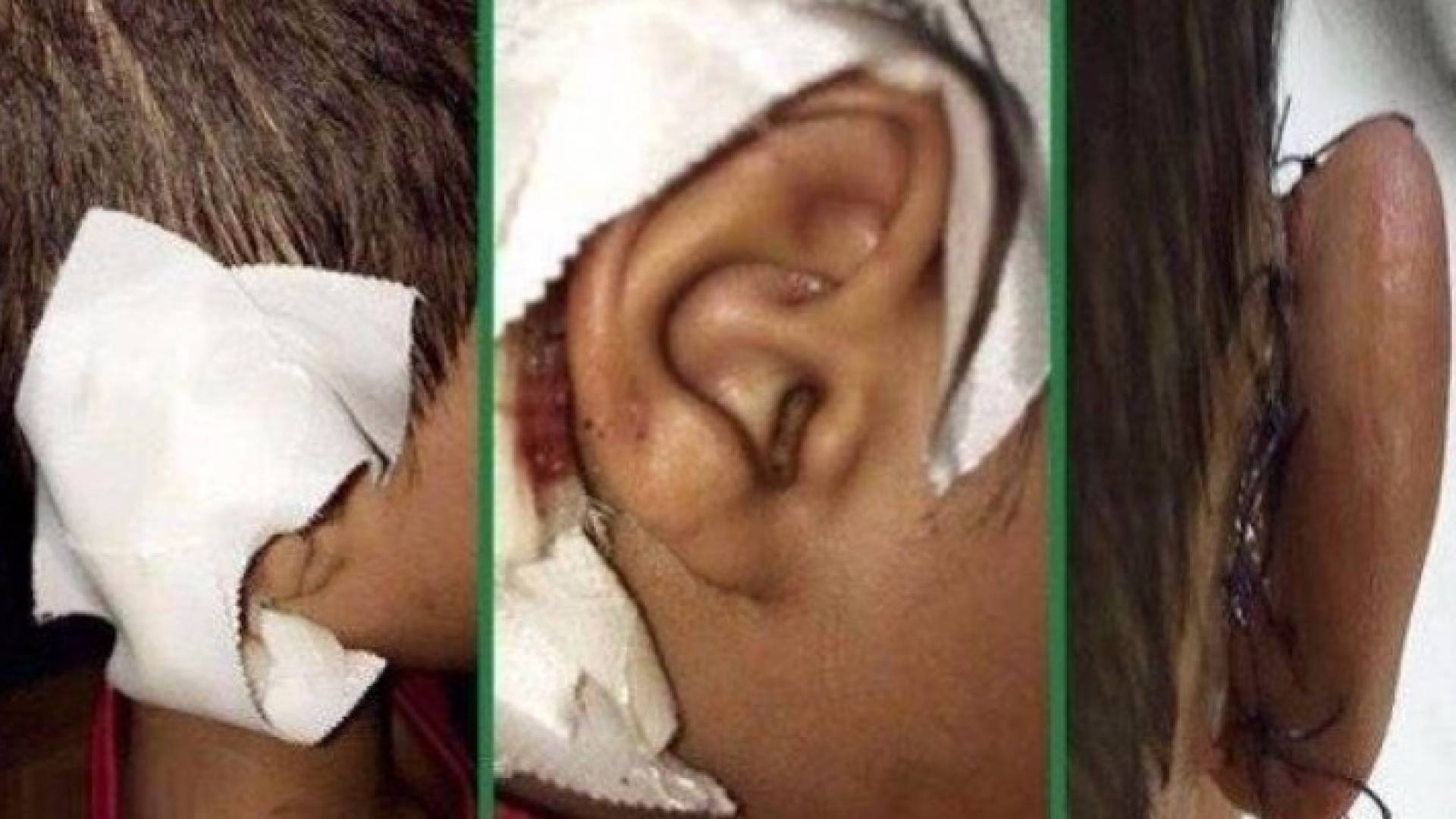 معلم يعاقب طفلا بخلع أذنه