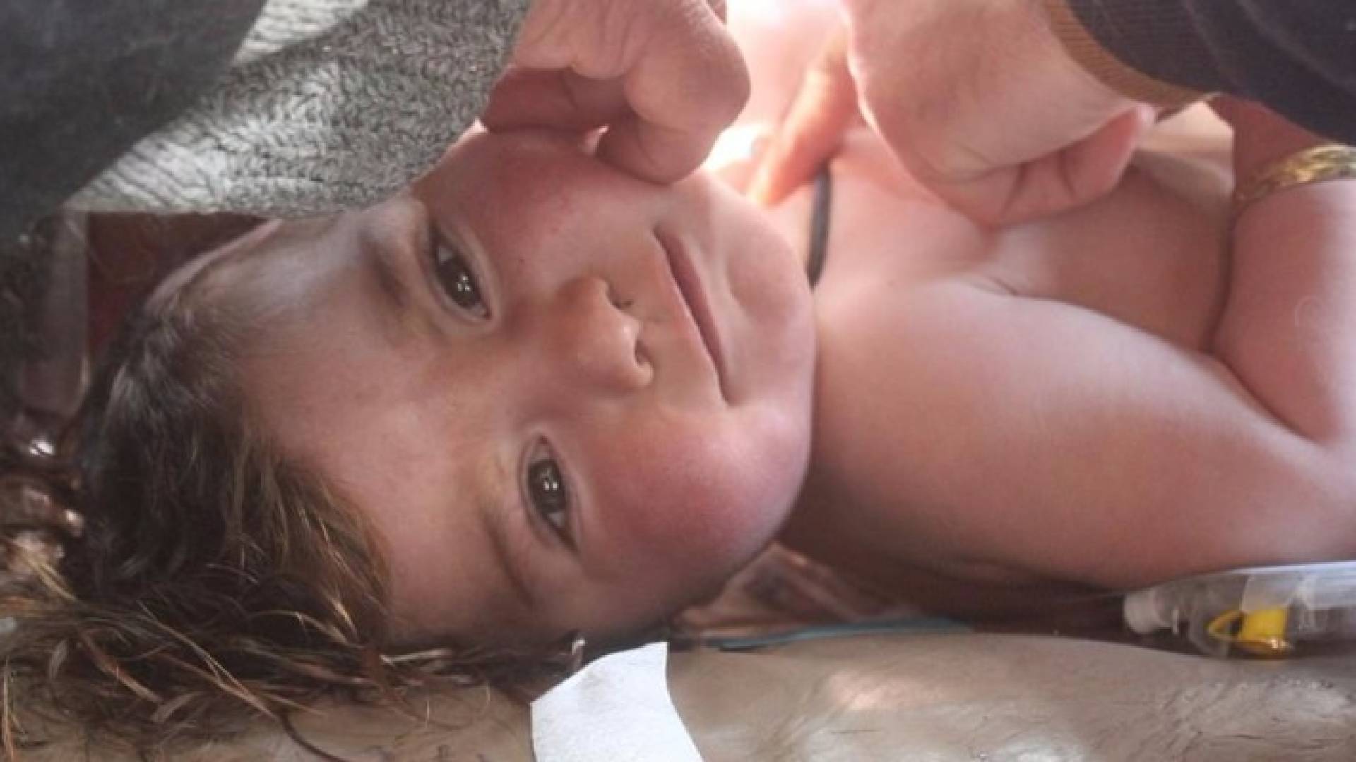 احد الأطفال المصابين بهجوم خان شيخون بريف ادلب