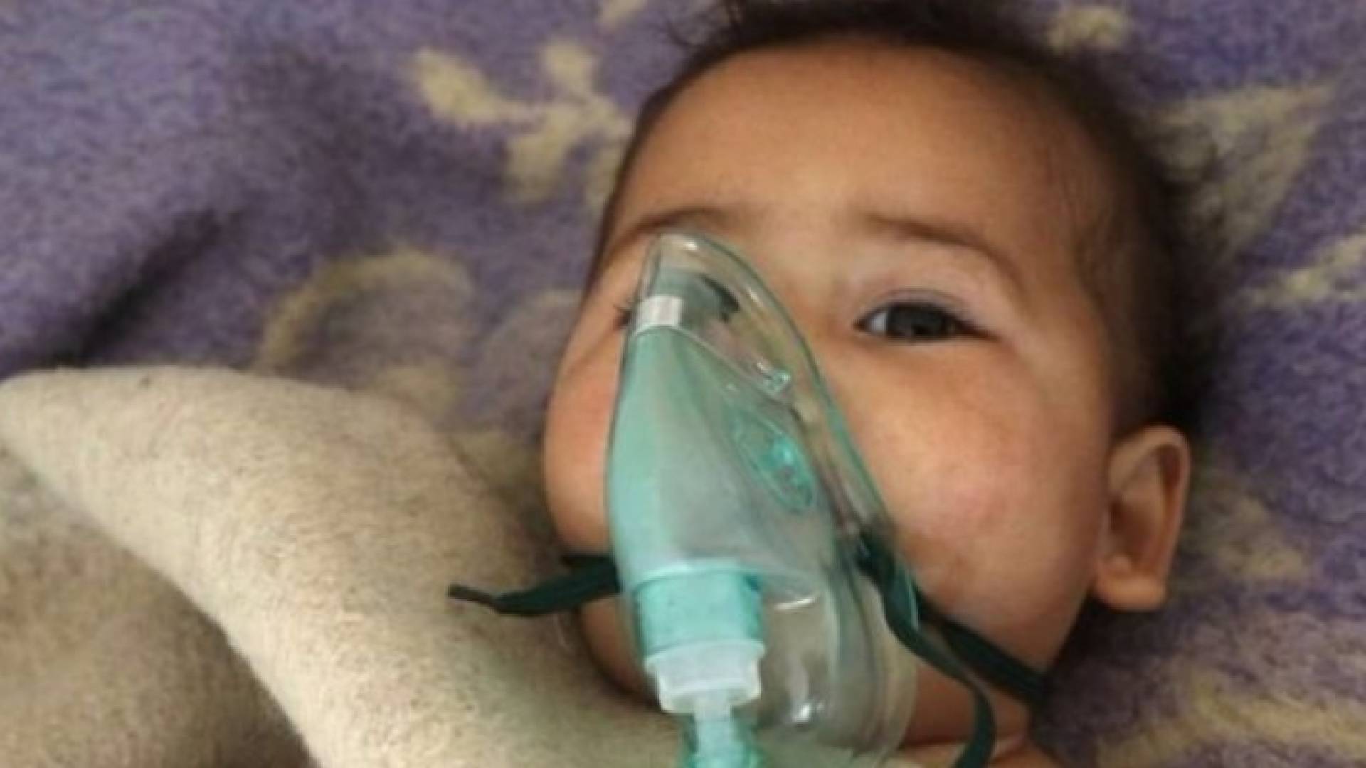 كان 20 طفلا بين الذين أصيبوا