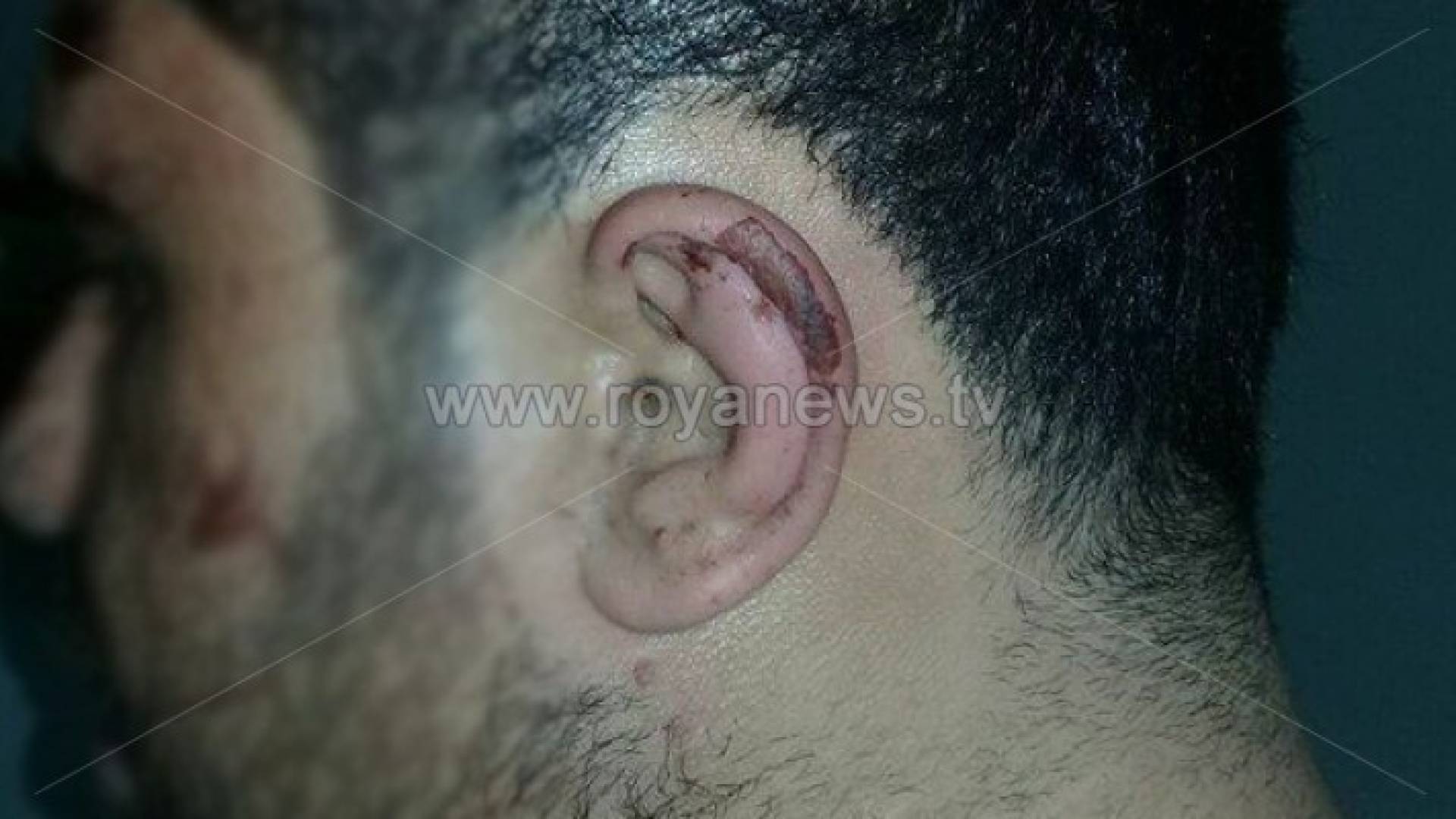 شابين يتعرضان للضرب والسلب بتهديد السلاح في اربد