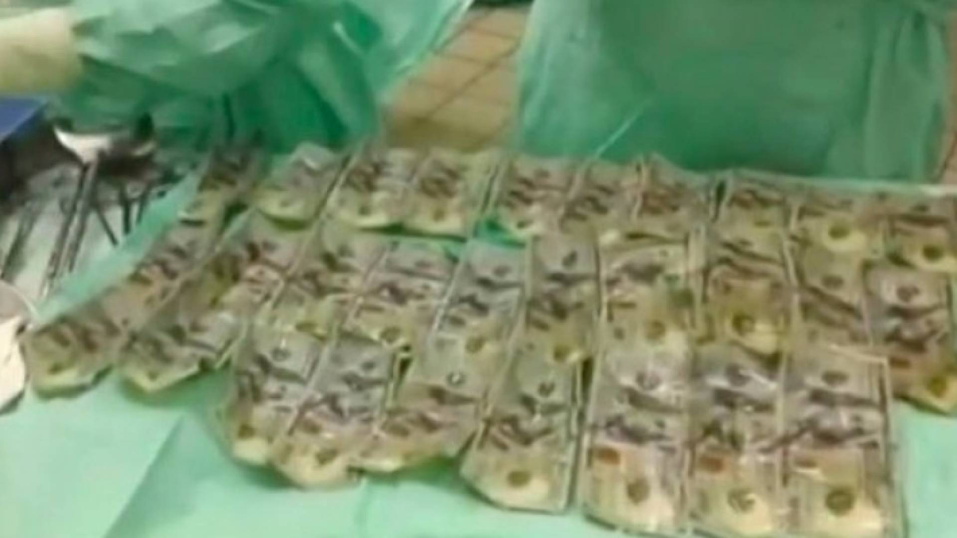 السيدة ابتلعت 7 الاف دولار