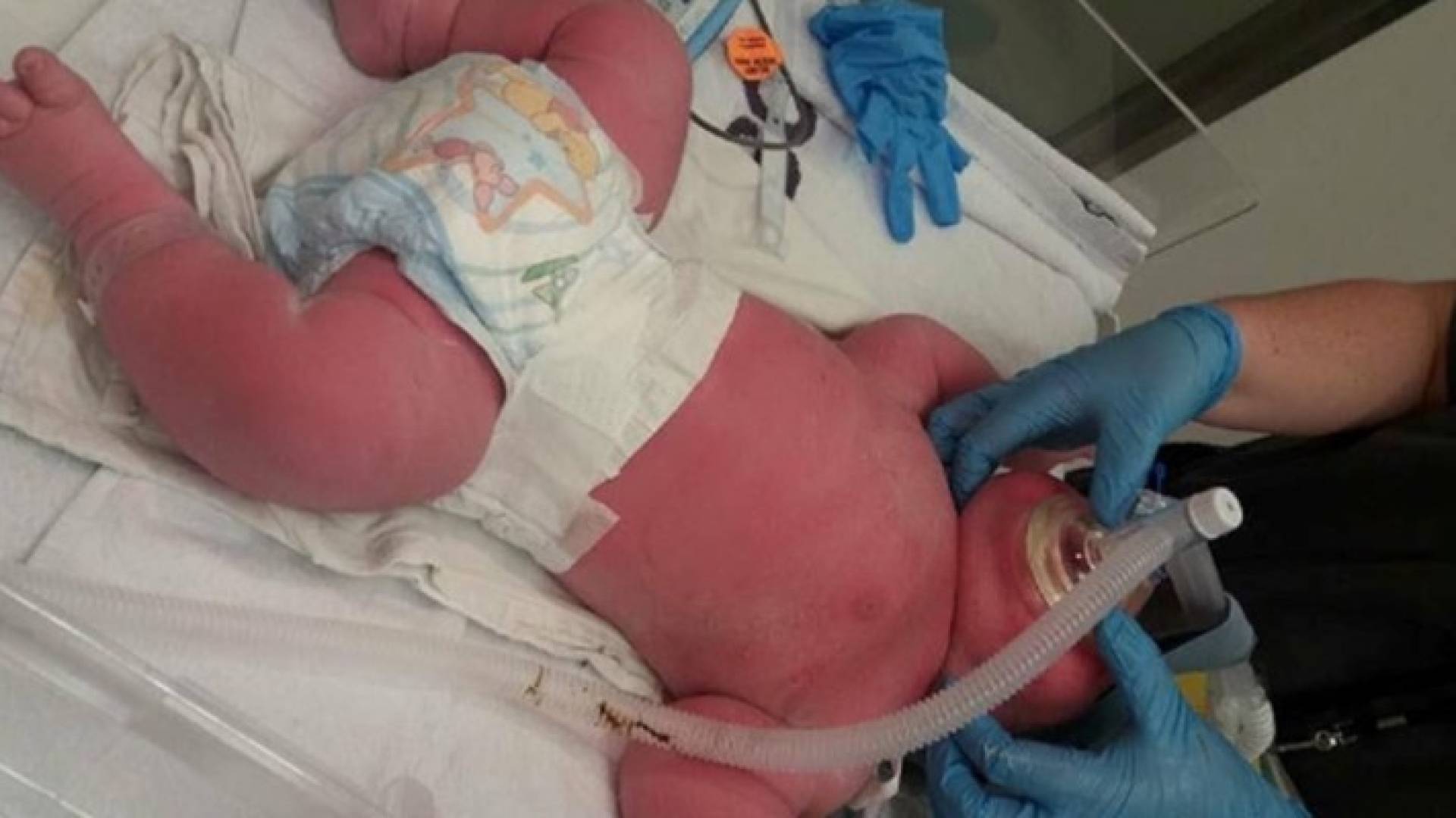 ذكرت والدة الطفل أنها كانت تعاني