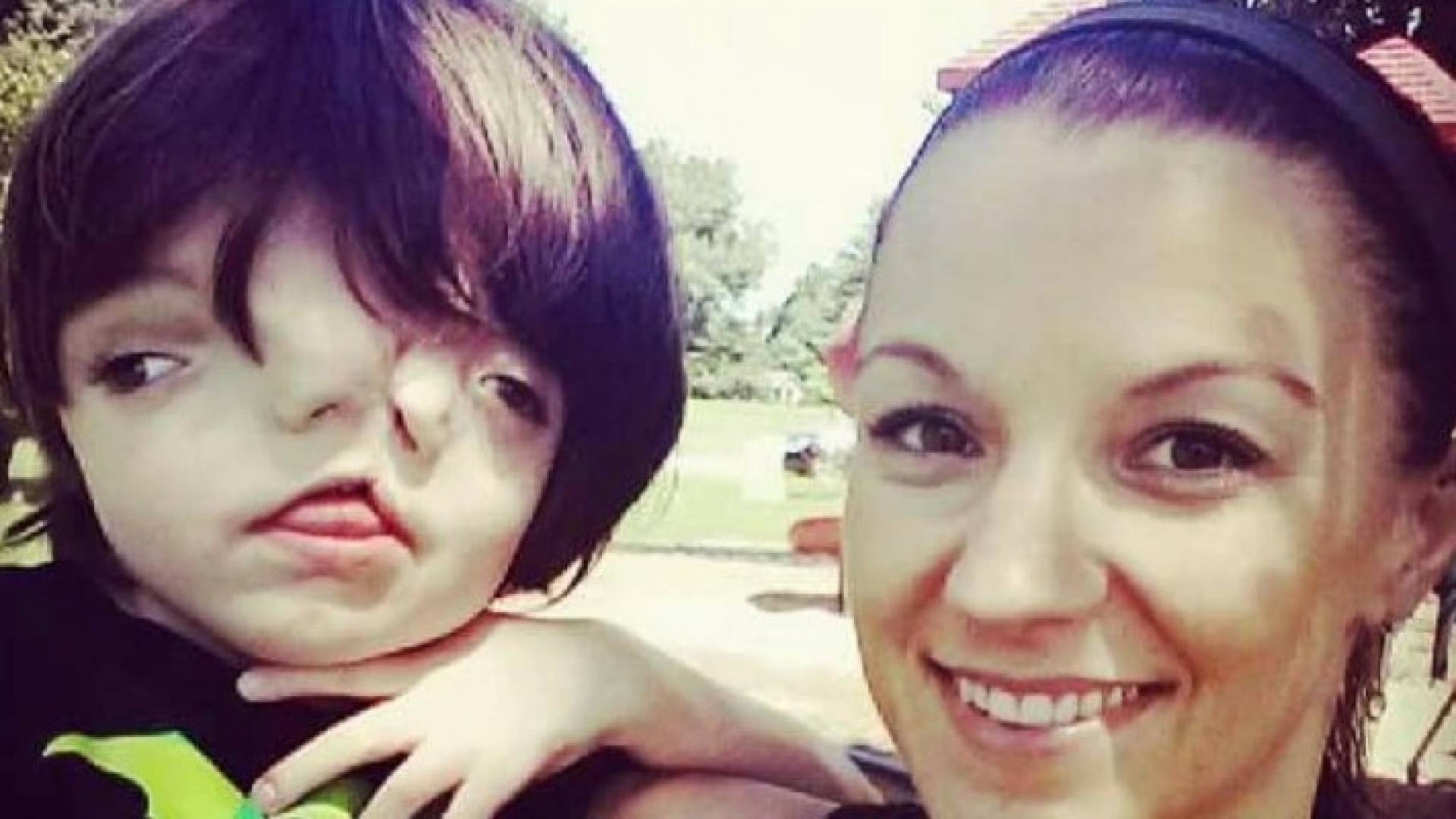 الصبي المعجزة تريس جونسون