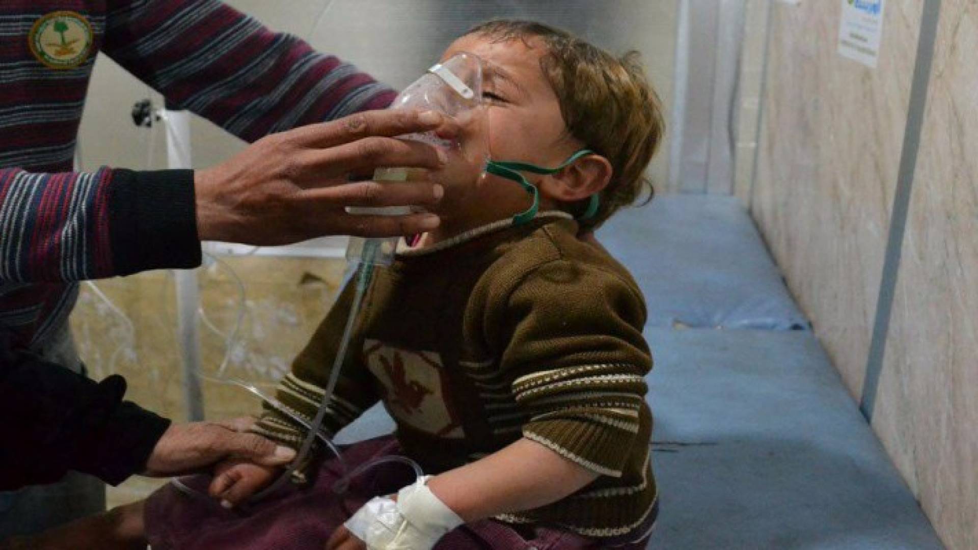 طفل سوري أصيب بغارة كيماوية شنها النظام على بلدة خان شيخون قبل أشهر