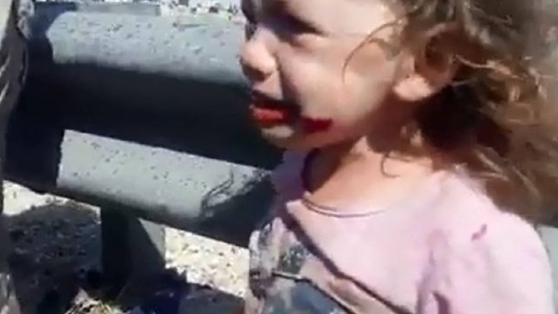 احد الأطفال المصابين