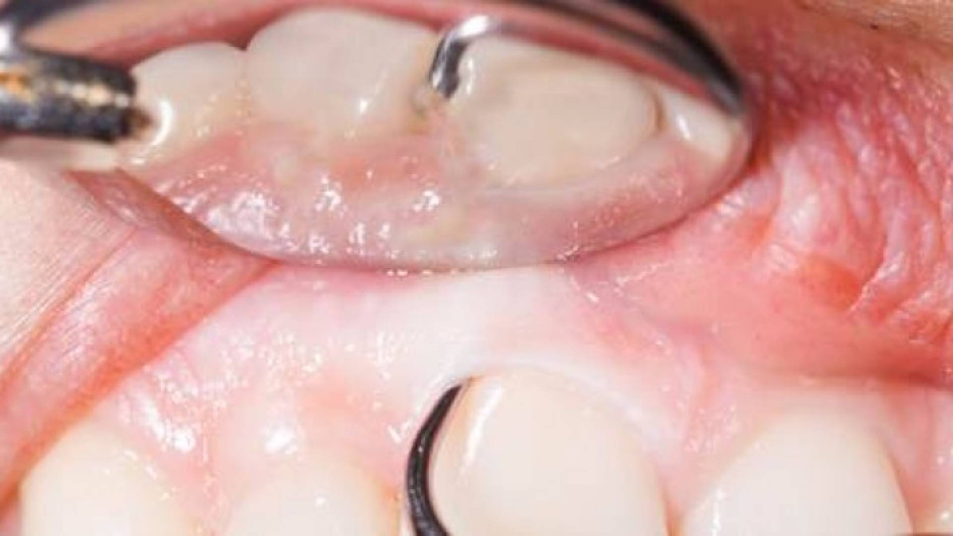 الصورة أرشيفية 