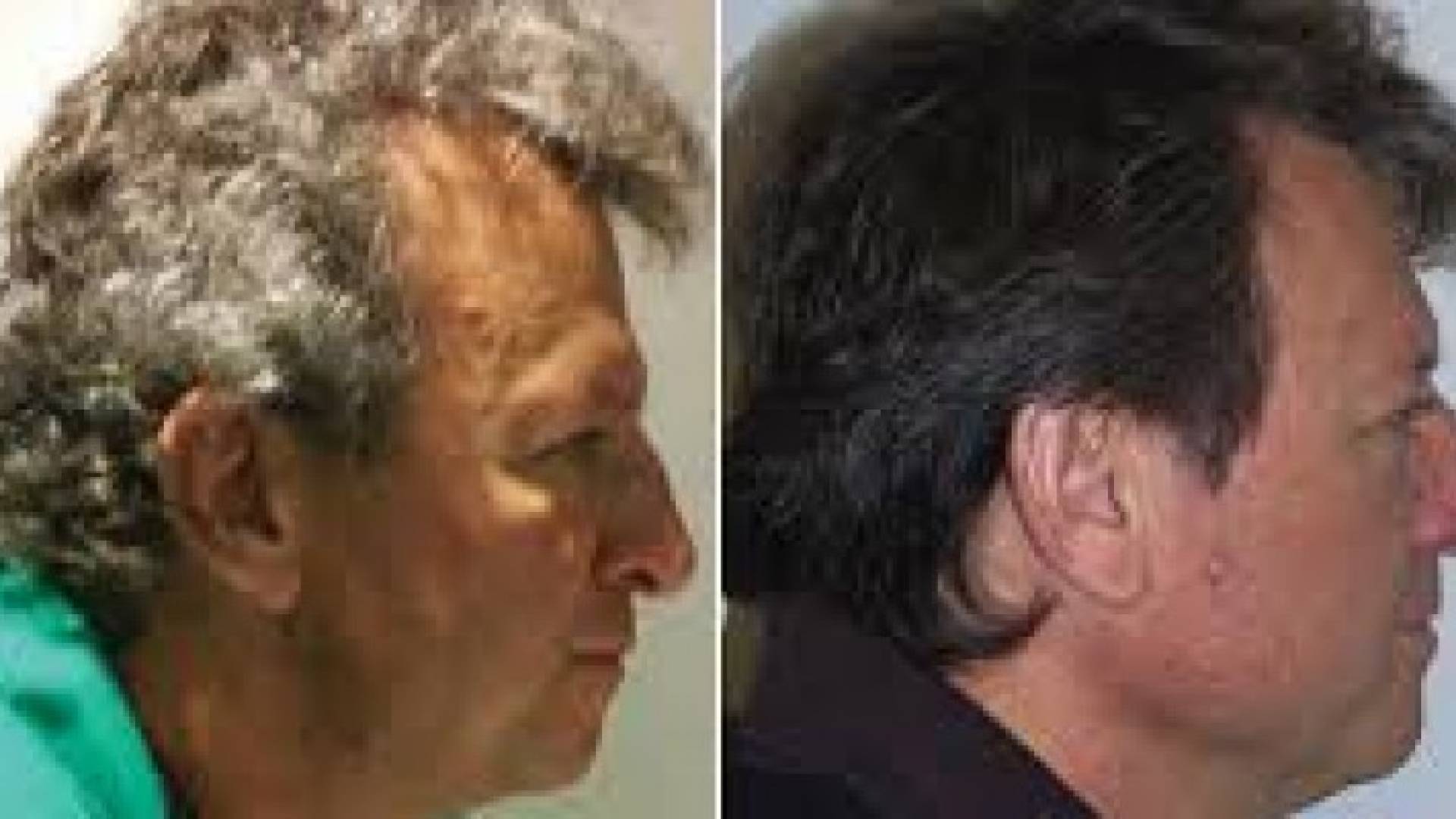  اقترحت دراسة إسبانية أن هذا العلاج المناعي الجديد للسرطان يعمل على إعادة صباغة شعر المريض