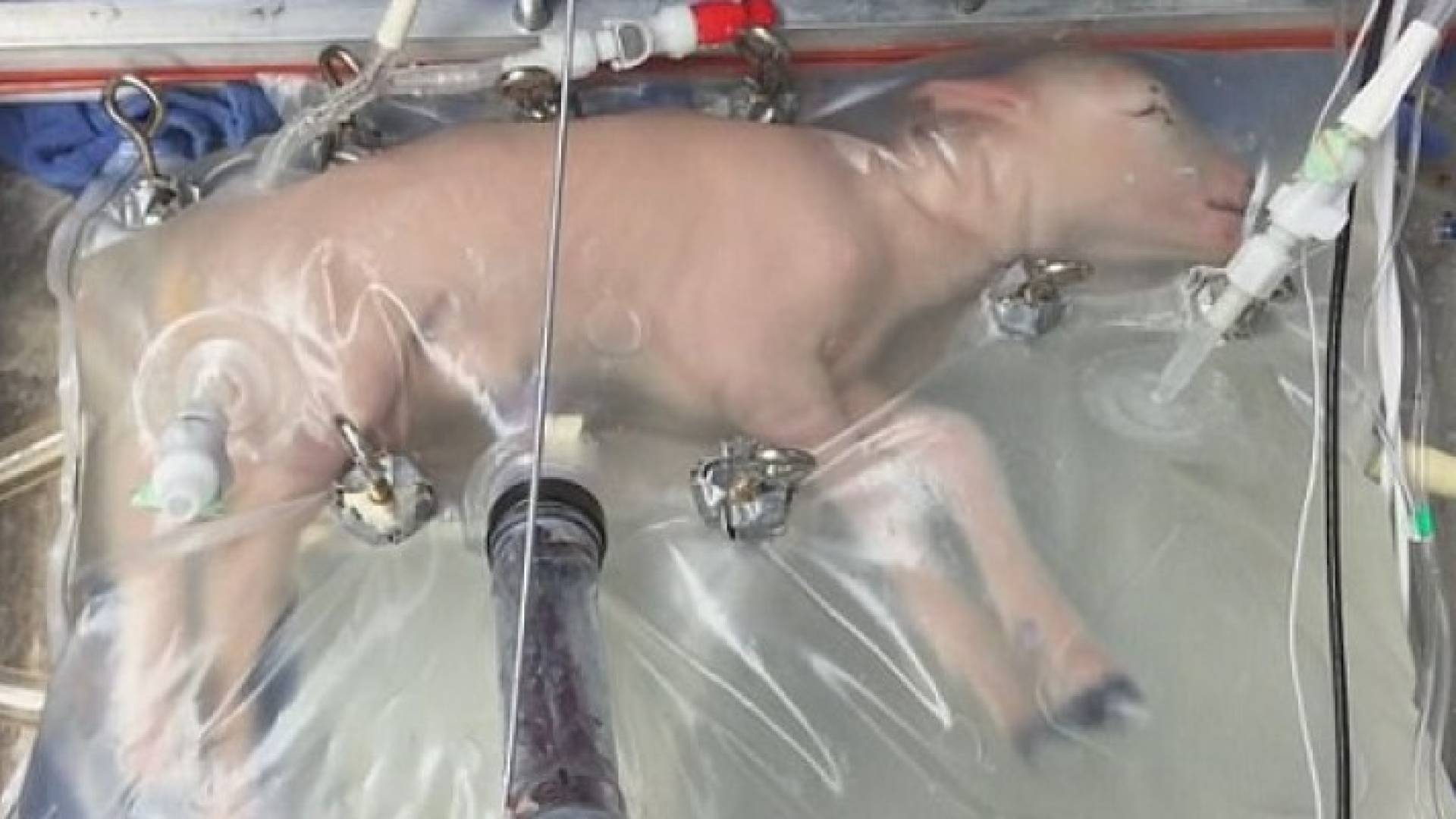 علماء أستراليون يبتكرون "رحم صناعى" ويأملون تطبيق التجربة على البشر