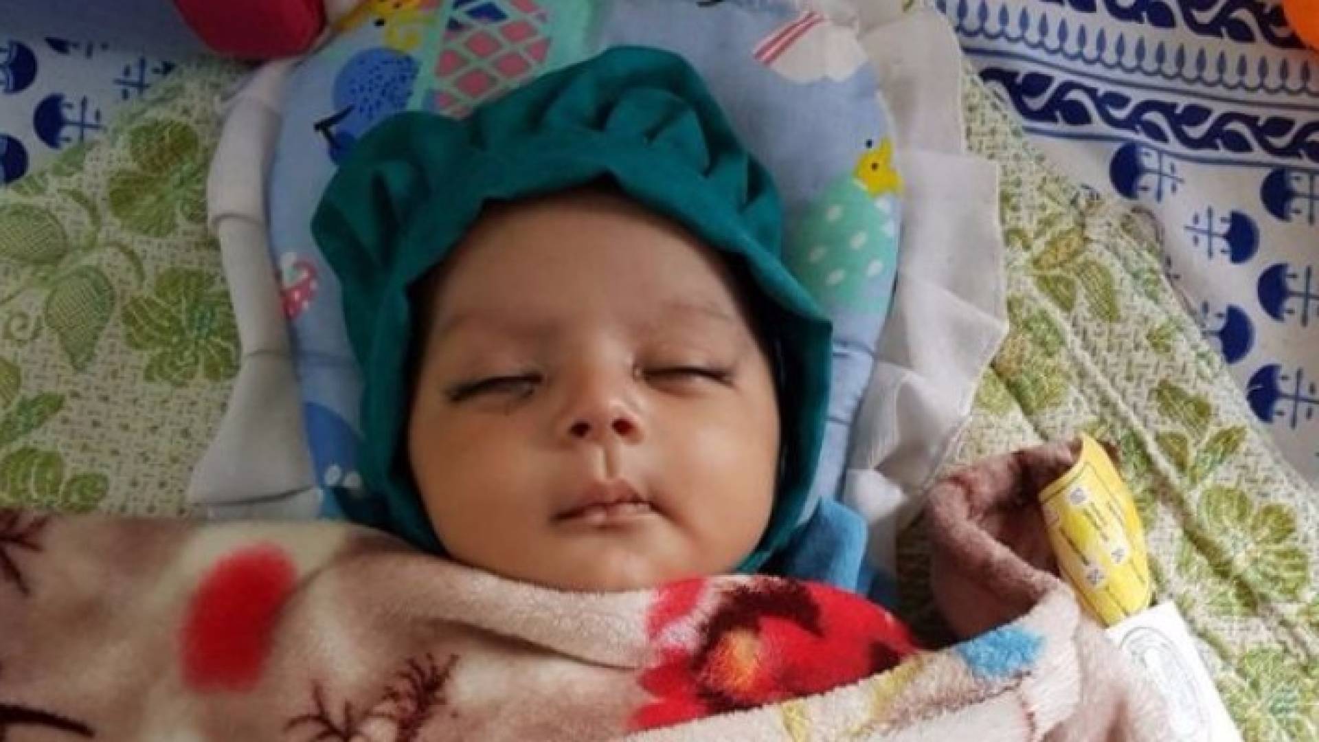 رضيع بعمر الـشهر لديه 7 أسنان