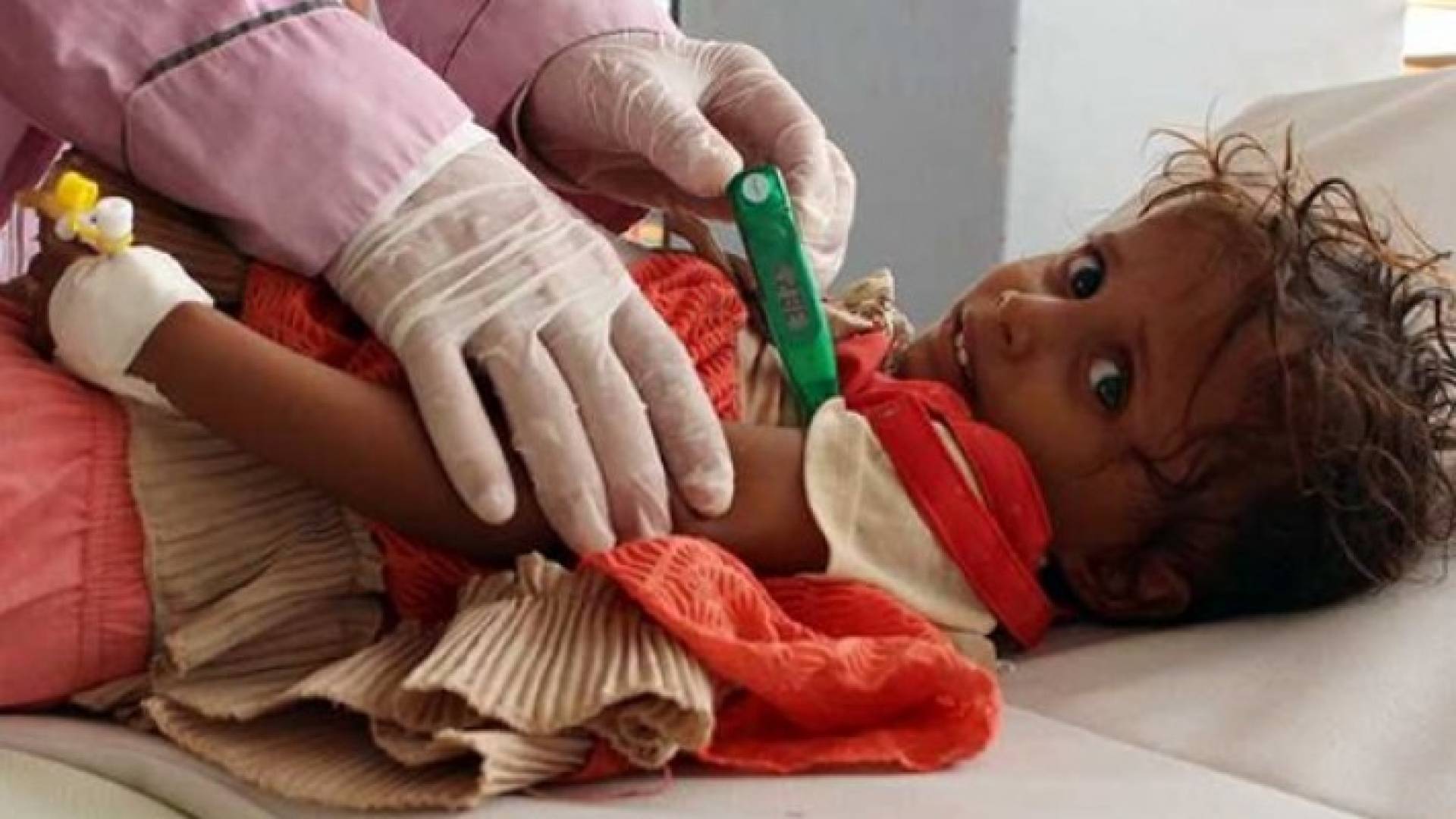 الصورة تعبيرية 